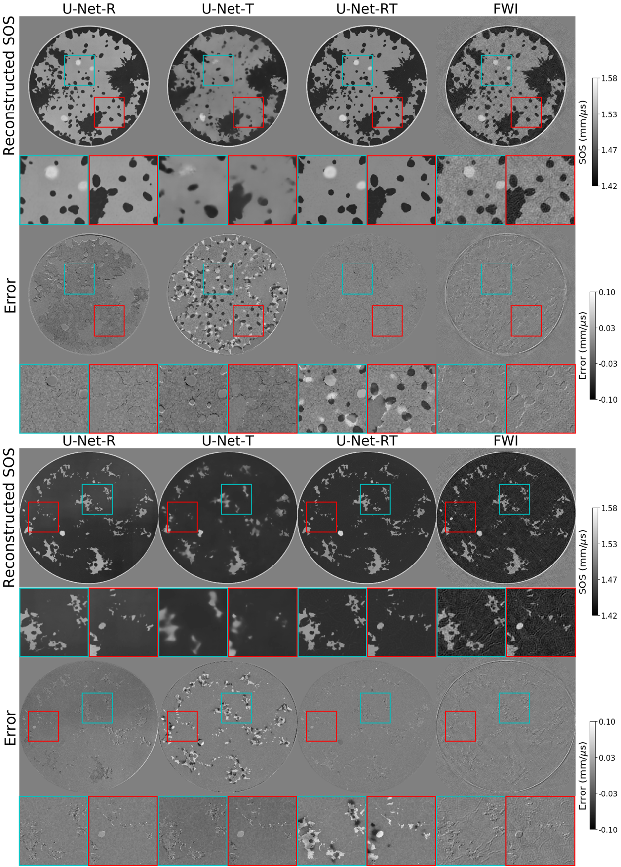 Figure 3: Comparisons of the SOS maps reconstructed by U-Net-R, U-Net-T, U-Net-RT, and FWI (from left to right) and the corresponding error maps, where the examples were drawn from the testing dataset. Images were cropped to a window of size 124mm-by-124mm. Square insets highlight specific patches (25mm-by-25mm) within the images, with zoomed views shown below each image. Compared to the U-Net-RT, the estimates from the U-Net-R exhibit bias and those from the U-Net-T contain false structures, while the SOS maps reconstructed by FWI display artifacts.