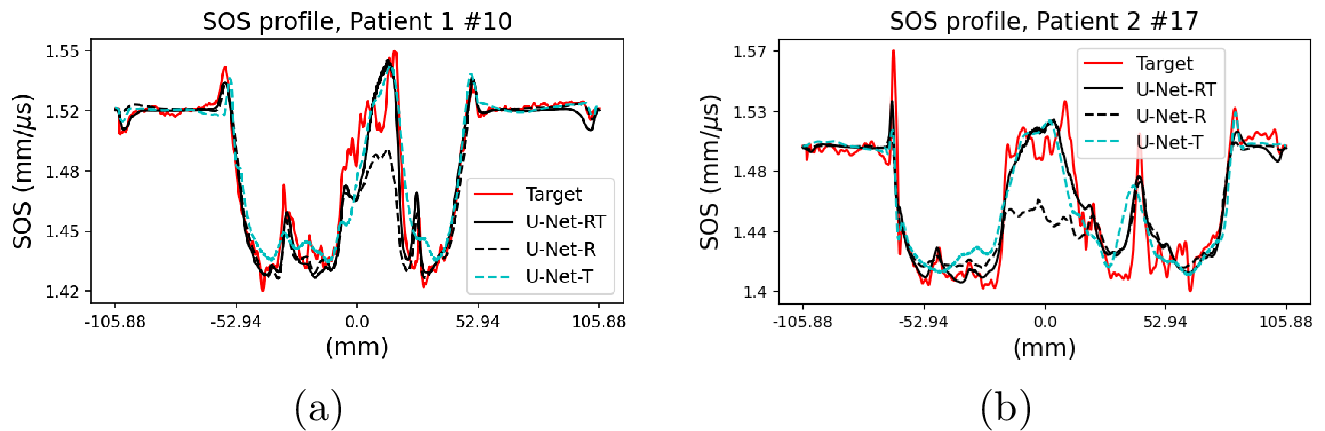 Figure 9: Comparison of SOS line profiles for (a) Patient 1 \#10 and (b) Patient 2 \#17, corresponding to red dashed lines in Fig. 8. The results include the target SOS produced by FWI and the SOS estimates produced by the U-Net-RT, U-Net-R, and U-Net-T. The U-Net-R exhibits bias in certain high-SOS regions, while the U-Net-T output shows distortion at tissue boundaries when compared to the U-Net-RT results.