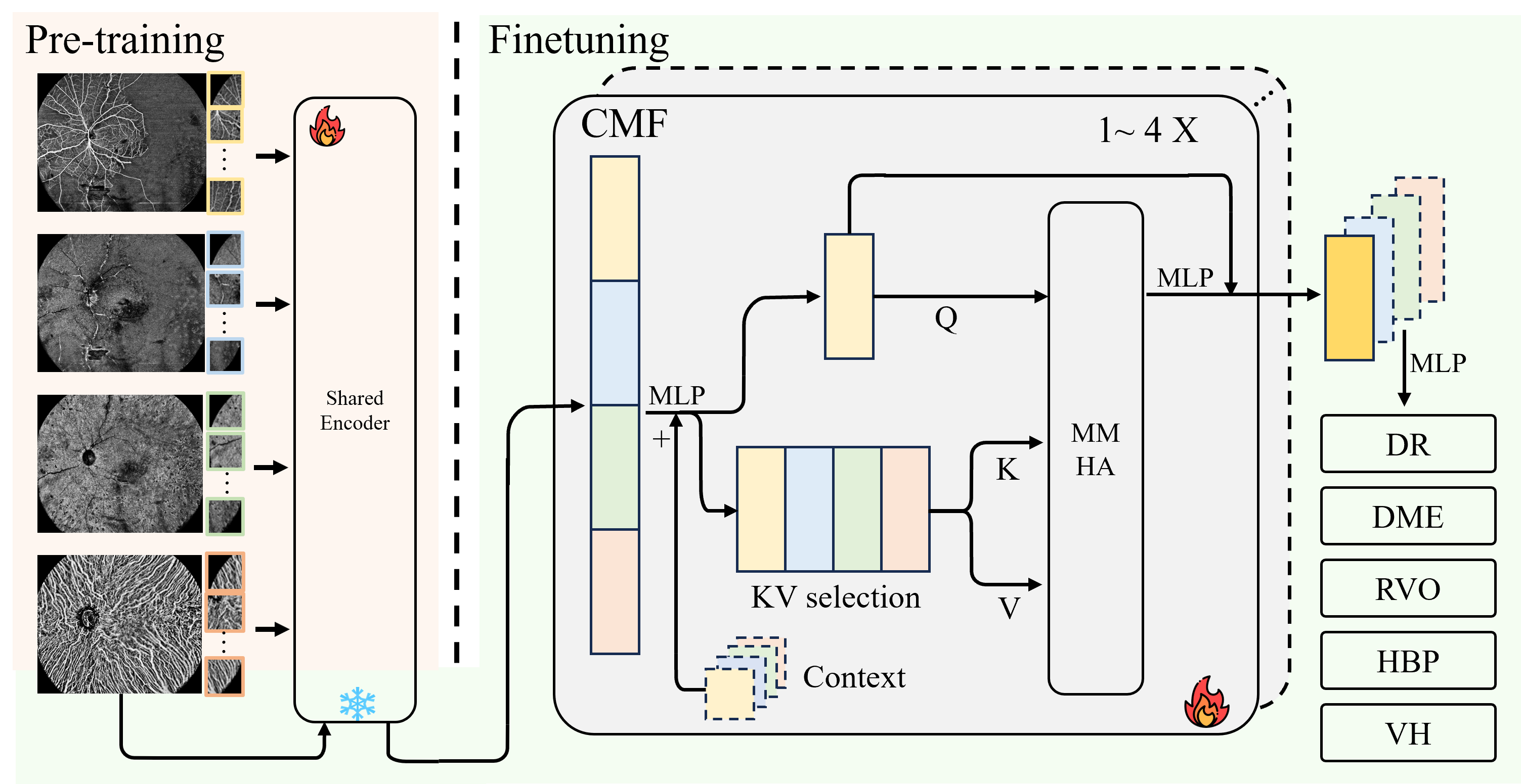 Figure 3: Our proposed framework for the cross-modal fusion and multiple retinal diseases diagnosis, including two steps: 1) encoder pretraining and 2) decoder finetuning. We first pre-train the vision transformer through the masked image modeling learning paradigm to learn multi-modal feature presentations. Then, freezing the encoder and adopting the proposed cross-modal fusion (CMF) block for each modality (share weights) to fuse the multi-modal features and extract the high-level semantics for the following diagnosis. During inference, our method can dynamically process inputs of varying modal numbers and provide stable and comparable performances.