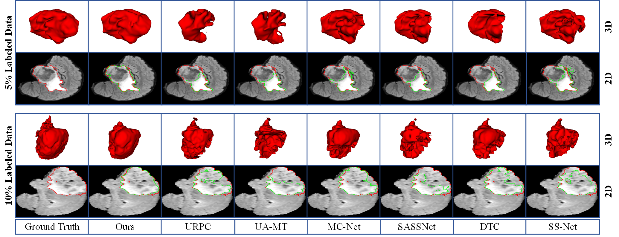 Figure 7: 2D and 3D Visualization with other methods on the BraTS2019 dataset under 5\% labeled data and 10\% labeled data. The red lines denote the boundary of ground truth and the green lines denote the boundary of predictions.