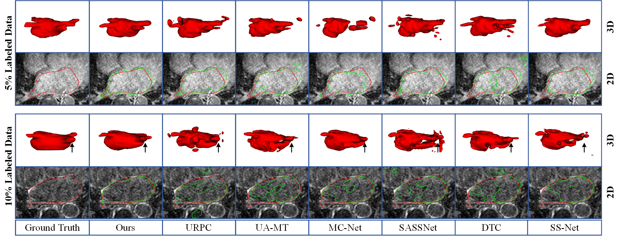 Figure 6: 2D and 3D Visualization with other methods on the LA dataset under 5\% labeled data and 10\% labeled data. The red lines denote the boundary of ground truth and the green lines denote the boundary of predictions.