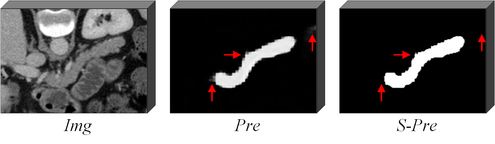 Figure 4: Demonstration of the sharpening operation. The Pre represents the prediction of the image, the S-Pre represents the results obtained after applying the sharpening operation to the Pre.