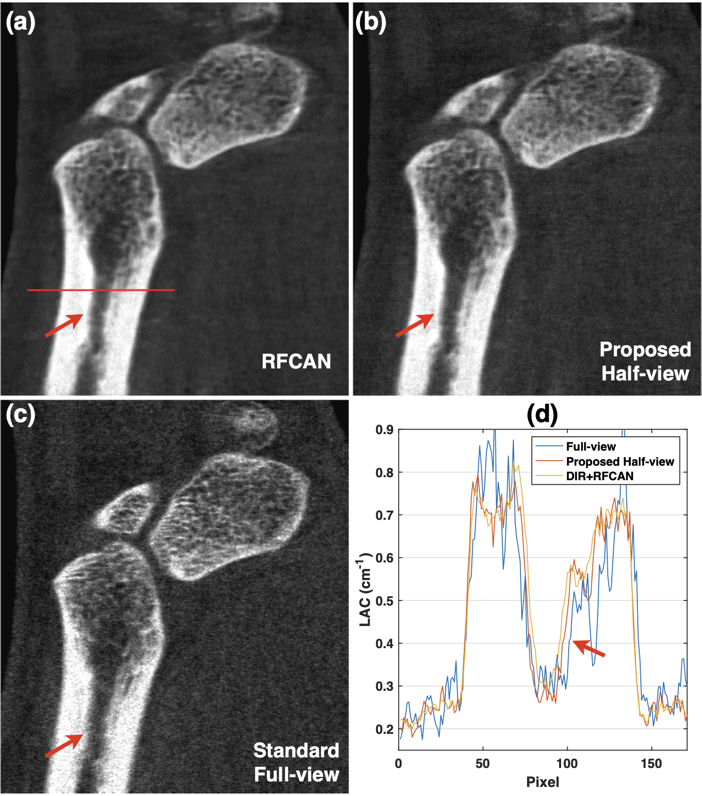 Figure 13: Visual comparison between (a) intermediate RFCAN result, (b) final half-view reconstruction, and (c) MARS full-view reference in the channel 7-40keV, displayed in W/L:0.72/0.5 cm^{-1}, accompanied by (d) plots of their intensity profiles along the red line. Note the bony structure differences in the upper part of images are due to misalignment, as explained in Fig. 3 (a).