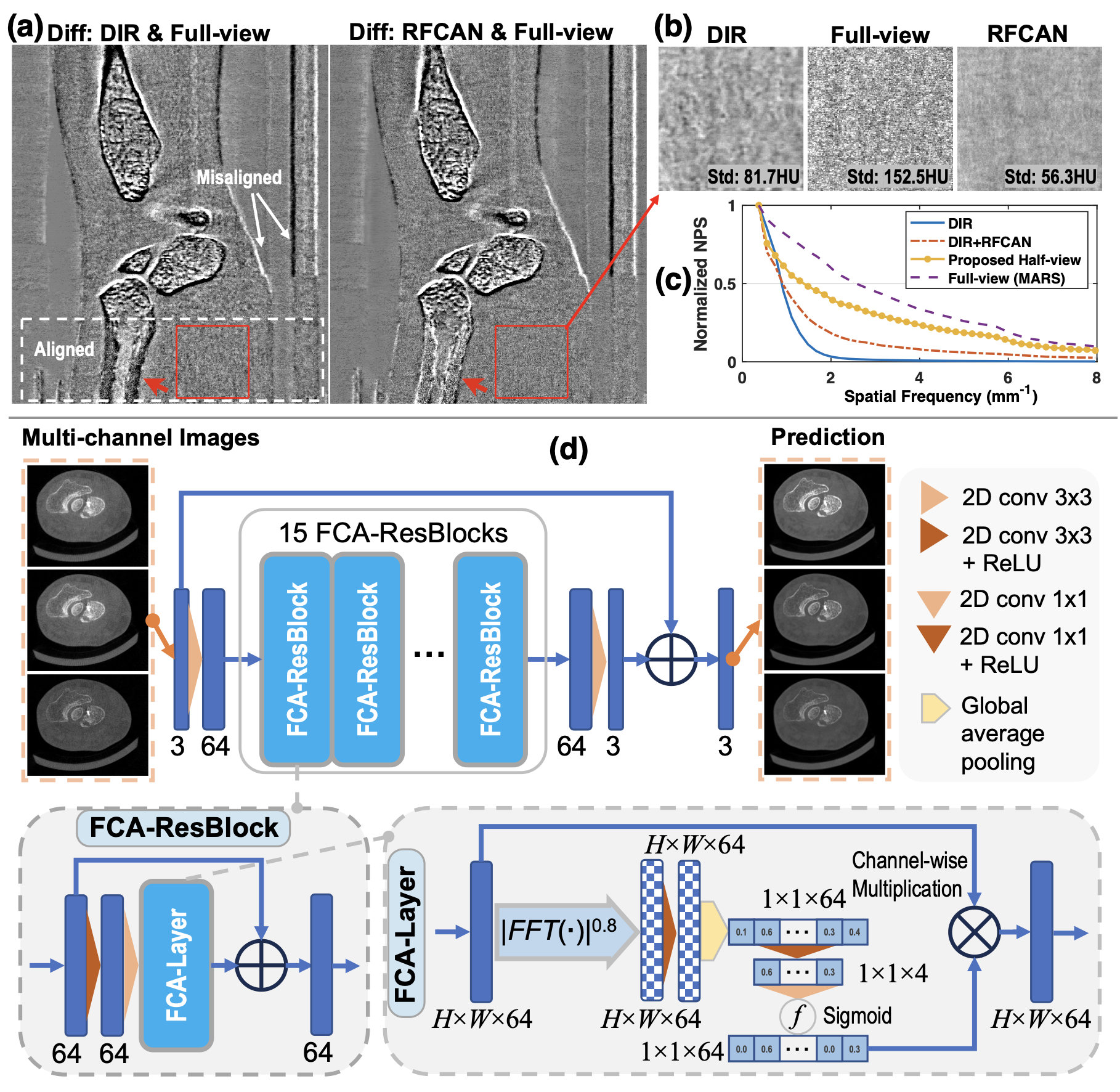 Figure 3: Motivation and architecture of the residual Fourier channel attention network (RFCAN). It mainly intends to (i) correct contrast shift, and (ii) adjust noise texture to match clinical references. (a) The difference images of deep iterative refinement (DIR) results and RFCAN results, against the MARS full-view reconstruction reference, reveal clear misregistration in the upper part of the volume—highlighting the need for a misalignment-insensitive loss function. A slight value shift for bones is also observed in the DIR result, indicated by the dark region pinpointed by arrows. (b) Zoomed-in views of a flat tissue region show a notable texture discrepancy between the DIR result and the reference, despite their similar noise levels (standard deviation) and mean values. (c) Noise power spectrum (NPS) curves, estimated from the flat tissue region, further confirm this texture difference, motivating the alignment of bone values and the adjustment of noise characteristics to reduce perception bias using RFCAN. (d) The proposed RFCAN consists of 15 Fourier channel attention residual blocks (FCA-ResBlocks) built upon the attention layers with FCA (FCA-Layer). It functions as a post-processing procedure that was applied to the multi-channel DIR outputs.