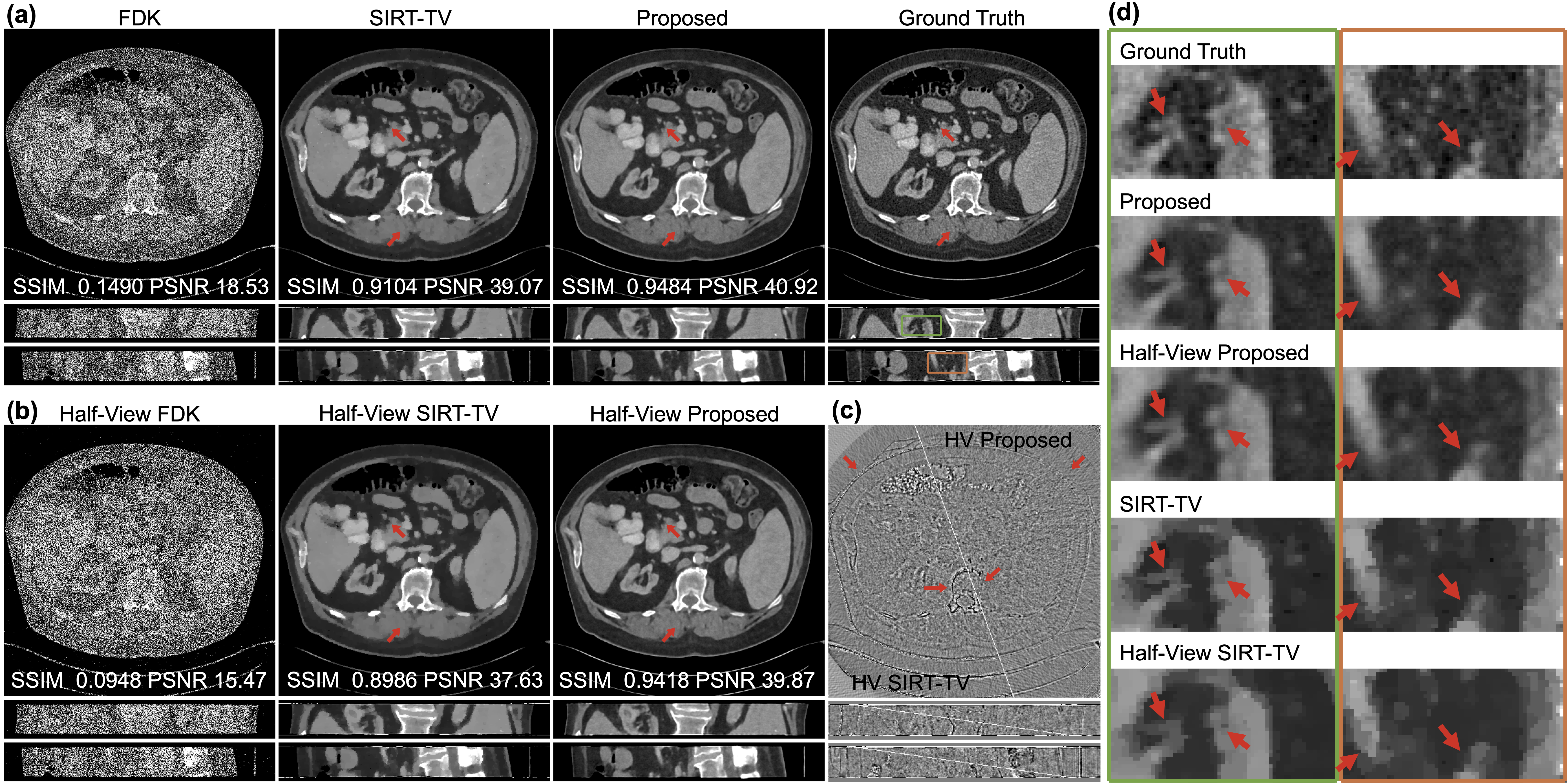 Figure 5: Representative images reconstructed using the competing methods on simulated data. (a) The full-view reconstructions with FDK, SIRT-TV, and our method displayed against the ground truth, including exemplary axial, coronal, and sagittal views from top to bottom; (b) the reconstructions from halved views; (c) error map of half-view reconstructions against ground truth for the SIRT-TV (left half) and the proposed method (right half); and (d) magnified regions from the coronal and sagittal views as indicated by the green and orange boxes respectively and displayed in the descent order of image sharpness and structural fidelity: ground truth, our full-view and half-view reconstructions, and full-view and half-view reconstructions with SIRT-TV from top to bottom. The display window settings are W/L:400/50 HU for images and W/L:200/0 HU for error maps. The red arrows highlight the structural details that are recovered for our methods but challenging for SIRT-TV, e.g., resulting in loss of resolution as indicated in (c) and a blotchy and cartoonish appearance as shown in (d).