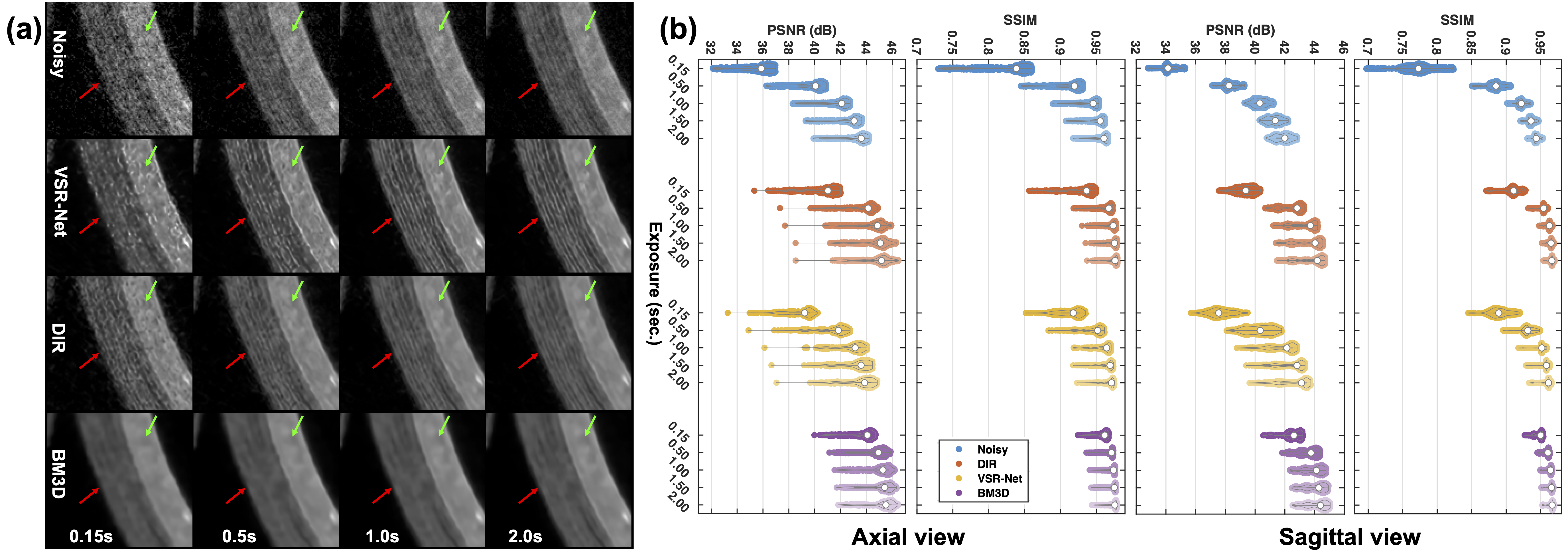 Figure 7: Zoomed comparison on the phantom scan under different noise levels accompanied by quantitative image quality evaluation. (a)Same magnified region as that in Fig. 6 (a) but from the datasets with exposures of 0.15, 0.5, 1.0, and 2.0 seconds respectively; and (b)violin plots of distributions of the PSNR and SSIM values for the axial and sagittal slices.
