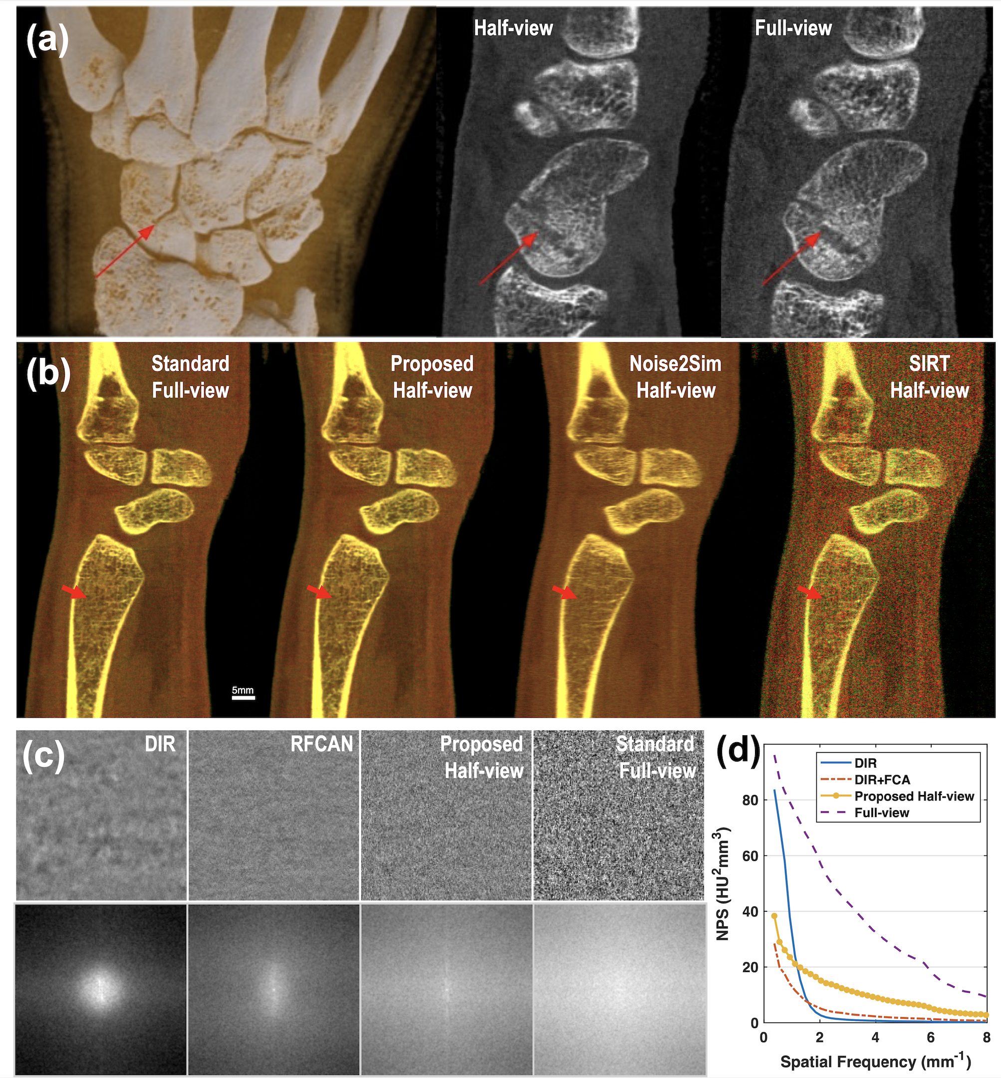 Figure 8: Sagittal view of a wrist joint reconstructed using the standard and proposed methods respectively. (a) From left to right are 3D rendering of the standard reconstruction, half-view and full-view images in the channel 7-40keV (manually aligned to show the same region, displayed in W/L:0.72/0.5 cm^{-1}), where the arrow points to a scaphoid fracture; (b) a color visualization of our three-channel reconstruction via linear blending [50] in reference to the standard full-view result and Noise2Sim half-view result. Our result demonstrates high fidelity in both spectral values (same color tone and brightness as the full-view) and spatial structures (sharp and accurate fine details as pointed by the red arrow); (c) zoomed-in views of noise texture from a flat tissue region in our half-view reconstruction (7-40keV channel) illustrate the texture changes across different stages; and (d) the corresponding NPS curves demonstrate that, despite differences in noise amplitude, our final result closely matches the reference in spectral shape.