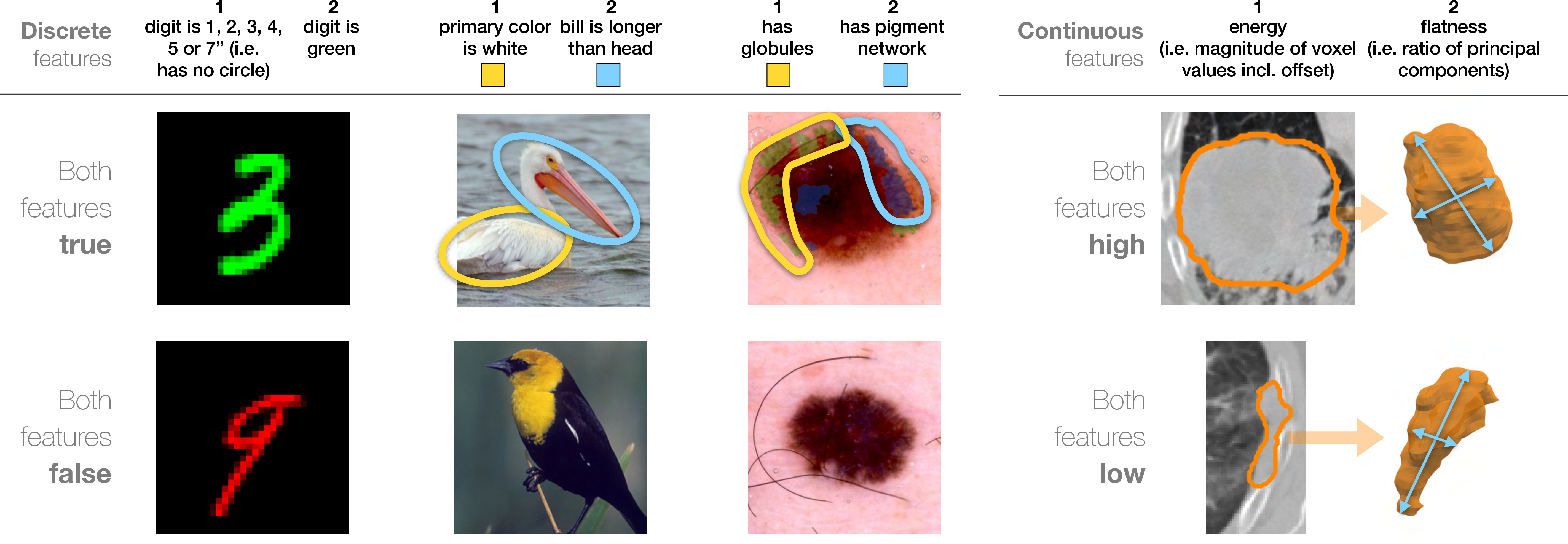 Figure 3: Image features from the four datasets, where either feature 1 or 2 is designated as predictive or prognostic biomarkers. ISIC 2018 skin lesion features are shown with ground truth masks. Globules (light green mask) manifest as darker dots, pigment networks have dark grid-like patterns of streaks with lighter “holes” (dark blue mask). The NSCLC-Radiomics images display tumor segmentation outlines of a 2D slice (left) or corresponding 3D volumes (right). Examples on the bottom row depict images where both biomarkers are either absent or have a low value.
