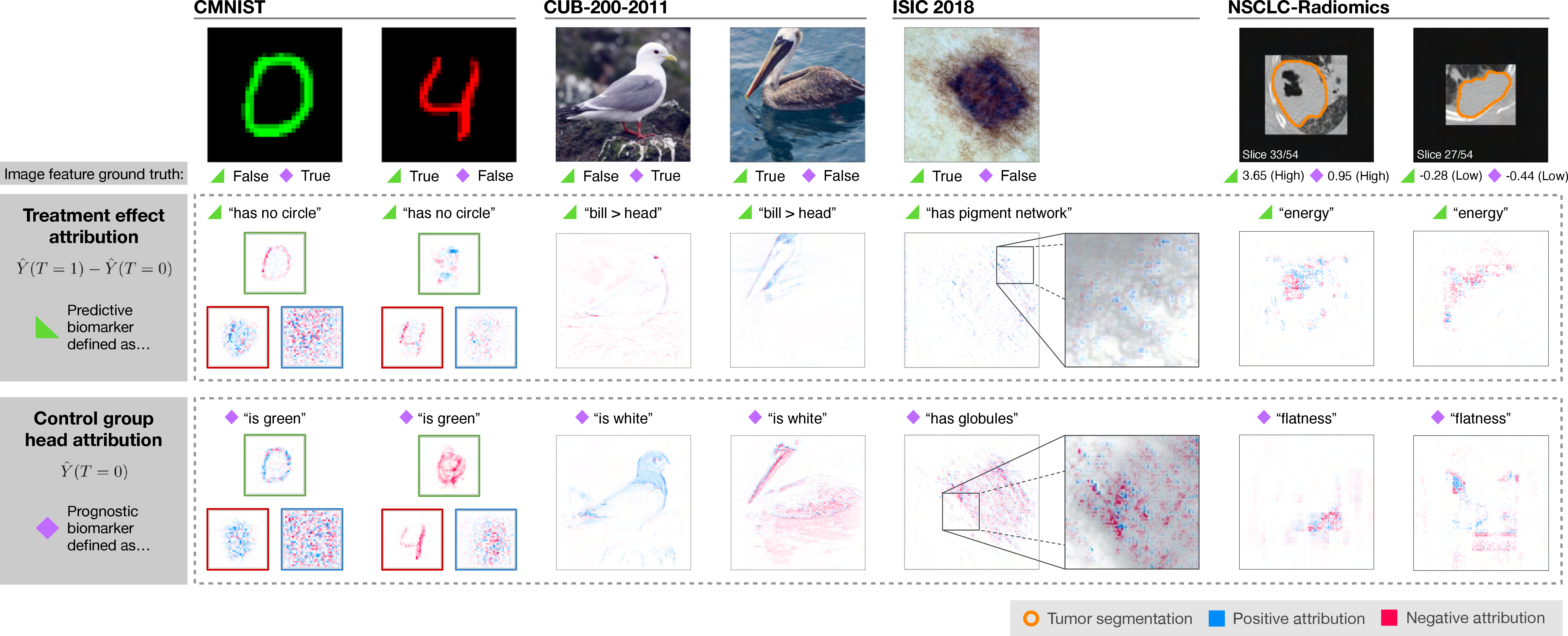 Figure 5: Attribution maps for the control group prediction head (last row) and the predicted CATE output (middle row) for different example images from each dataset (top row). For the CMNIST dataset, the attribution is shown for each RGB color channel (red: left, green: top, blue: right), as the color information is important for the biomarker prediction. An additional zoomed-in patch of the ISIC 2018 attribution map is overlaid with a grayscale version of the original image. For the NSCLC-Radiomics dataset, sagittal slices of the 3D patches are shown with orange outlines of segmented tumors. Here, results are based on models trained with b_{\mathit{pred}},b_{\mathit{prog}} = 1.0.