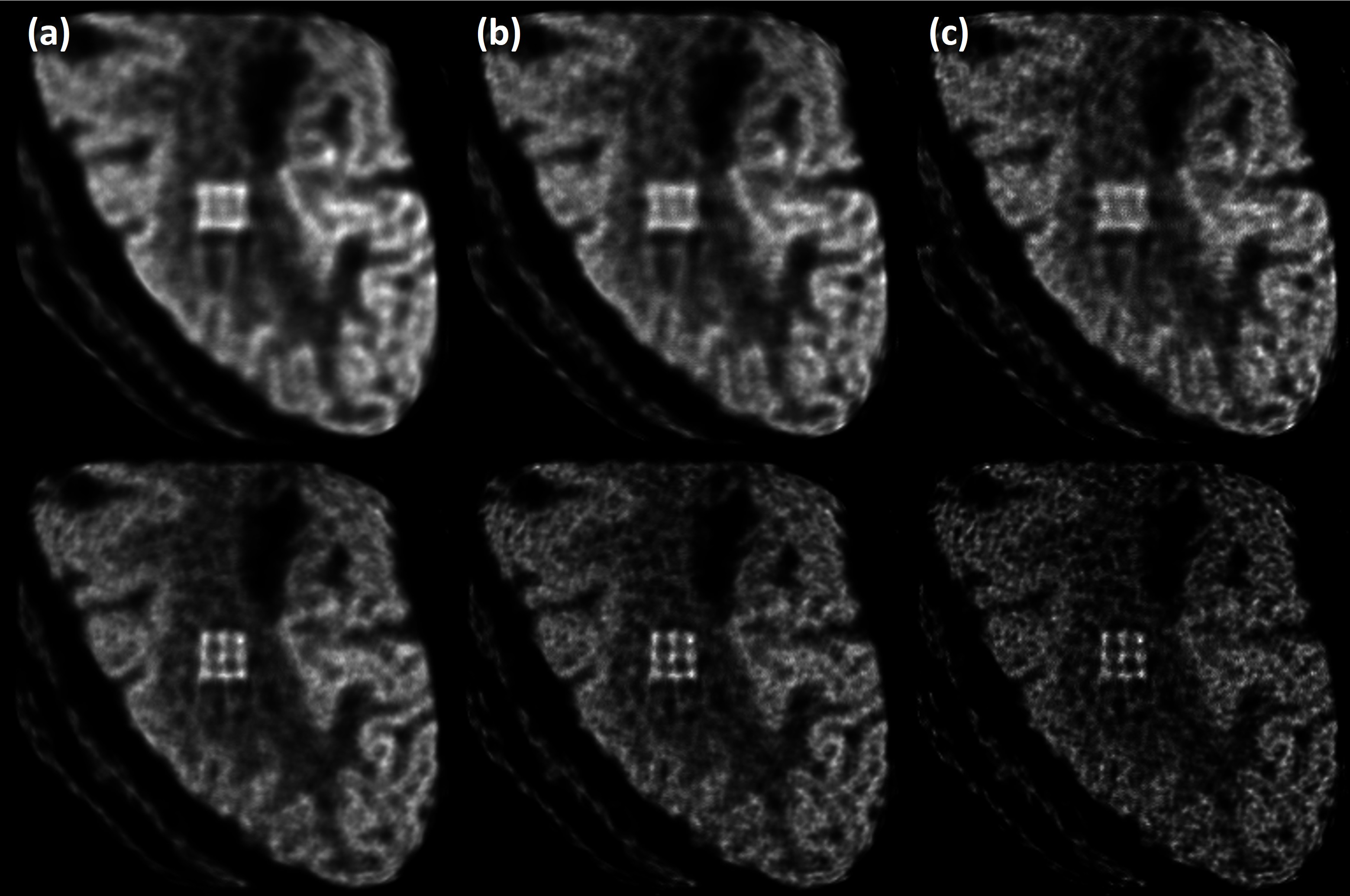 Figure 13: Noisy images obtained for the brain phantom by M0 (top) and M2 (bottom), using 20 (a), 50 (b), and 100 (c) OSEM iterations when adding Poisson noise to the analytically simulated data. The M0 and M2 data had 8.0M and 4.6M events respectively, corresponding the same scan duration.