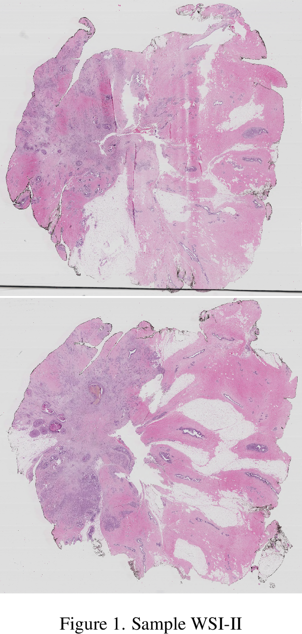 Figure 6: Sample WSI-I