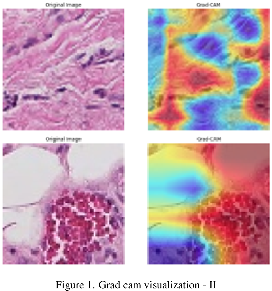 Figure 8: Grad cam visualization - I