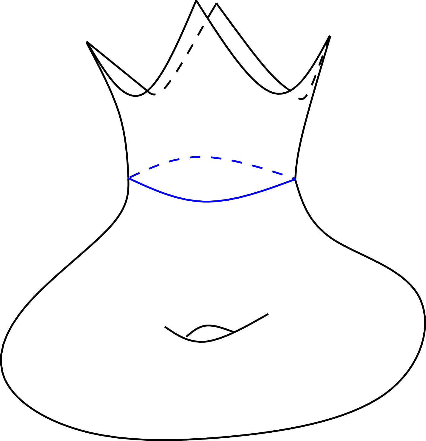 Figure 19: Once crowned torus.