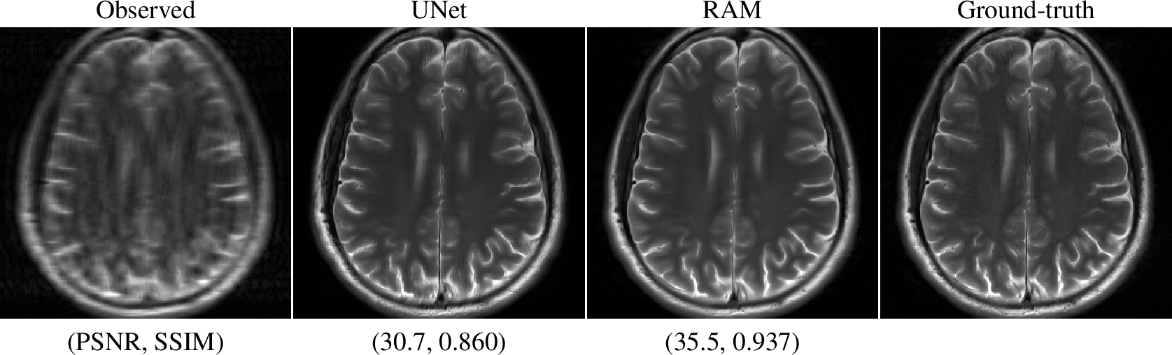 Figure 8: Results on the multi-coil MRI problem with acceleration factor 8. The UNet model is from [24].