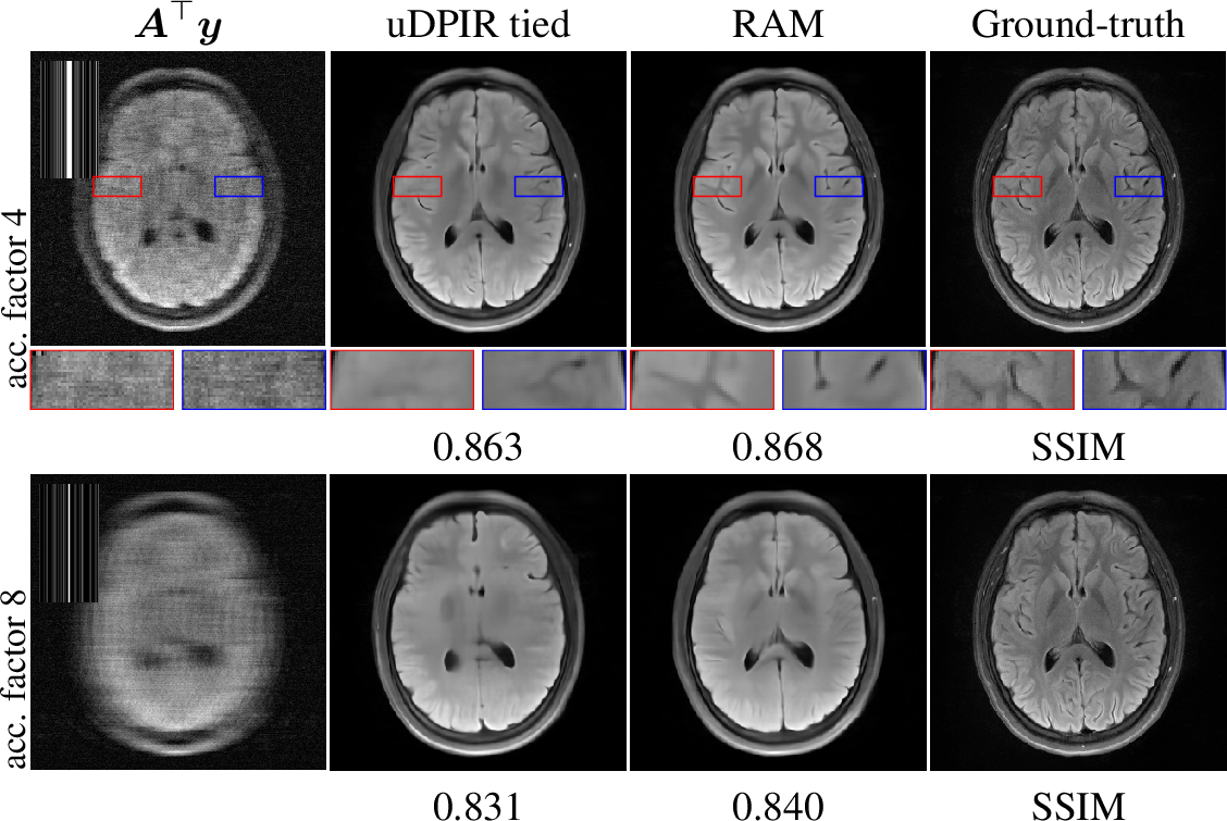 Figure 6: Results on MRI for acceleration factors 4 and 8. The Fourier mask is shown in the top left corner of the backprojection.