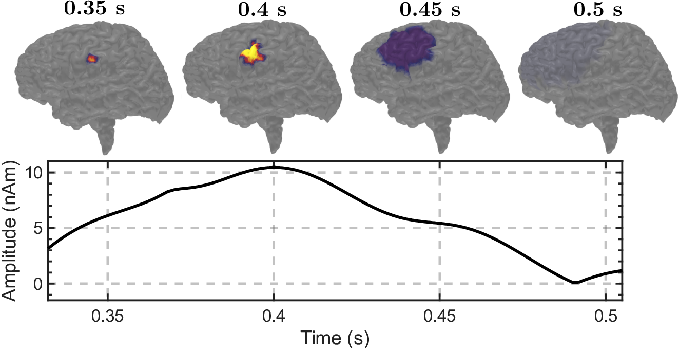 Figure 5: The simulated epilepsy activity with batch-like activity spreading in the spatial space as shown in the top row. The total dipole moment over time is calculated using the Jansen-Rit model, producing the curve shown at the bottom. The activity starts focal and stationary, then spreads, and its mass center moves to the frontal lobe.