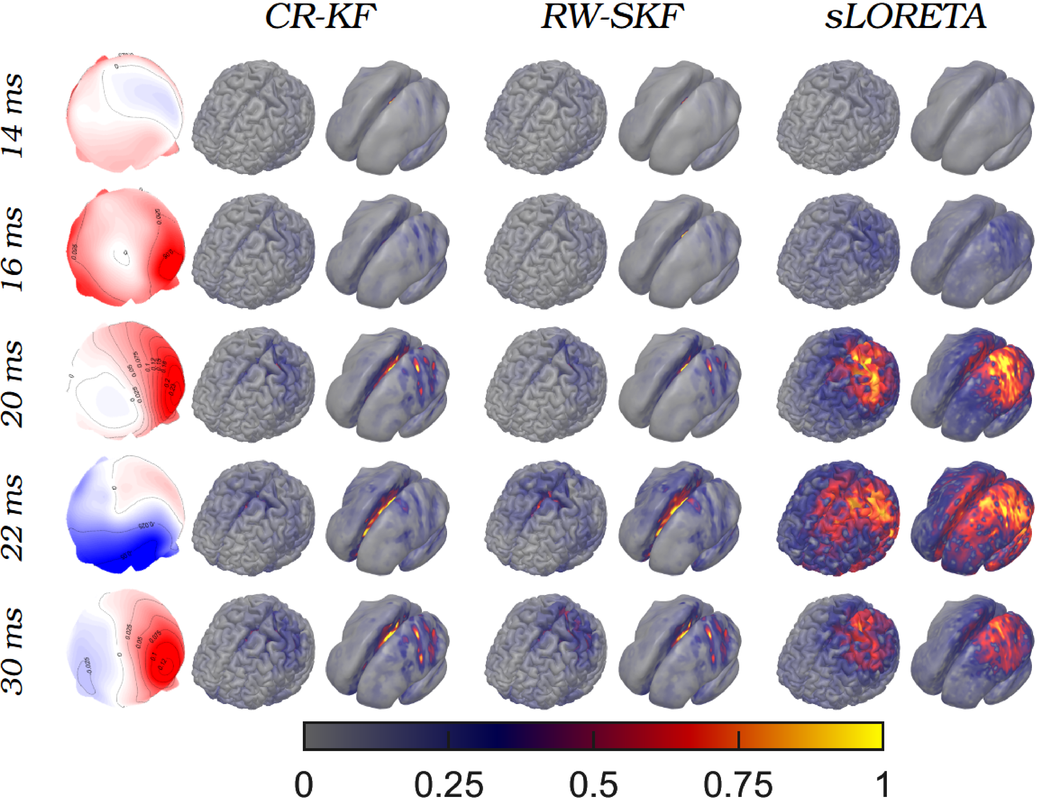 Figure 10: Visualization of spatial distribution of the Change Rate Standardized Kalman filter (CR-SKF), Random Walk-SKF (RW-SKF), and sLORETA estimations of the 1st subject’s somatosensory evoked potential peaks presented for each method in adjacent columns. The rows display the average post-stimulus time points. Next to these, topographies of the normalized peak activity are presented.