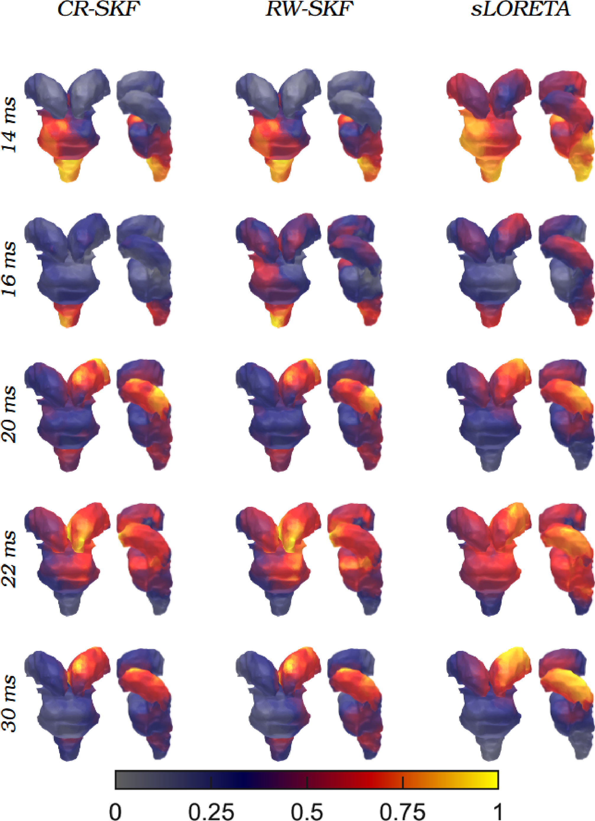 Figure 11: Visualization of spatial distribution of the Change Rate Standardized Kalman filter (CR-SKF), Random Walk-SKF (RW-SKF), and sLORETA estimations in the deep brain structures using the 1st subject’s data. Different rows present the activity at different somatosensory evoked potential peaks.
