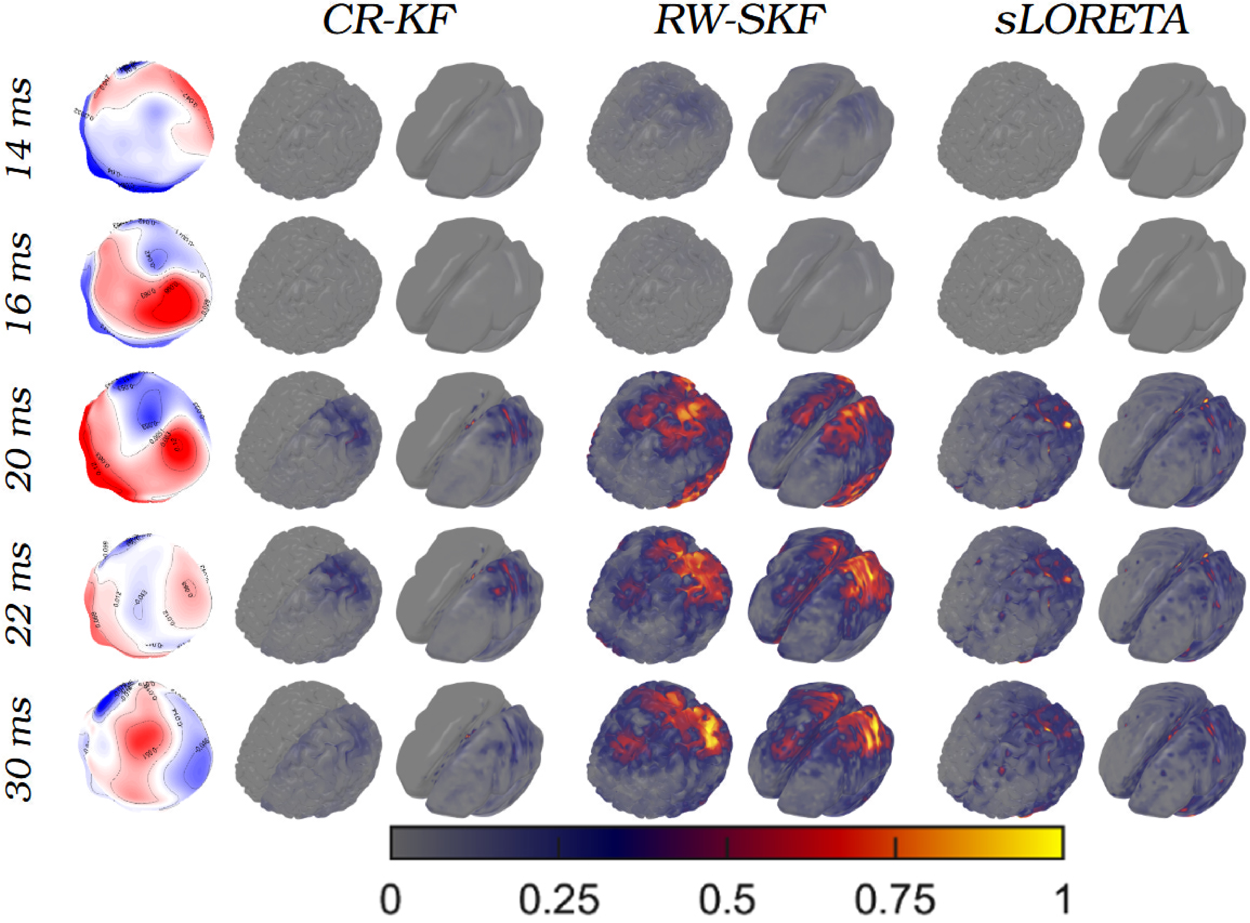 Figure 12: Visualization of spatial distribution of the Change Rate Standardized Kalman filter (CR-SKF), Random Walk-SKF (RW-SKF), and sLORETA estimations of the 2nd subject’s somatosensory evoked potential peaks presented for each method in adjacent columns. The rows display the average post-stimulus time points. Next to these, topographies of the normalized peak activity are presented.