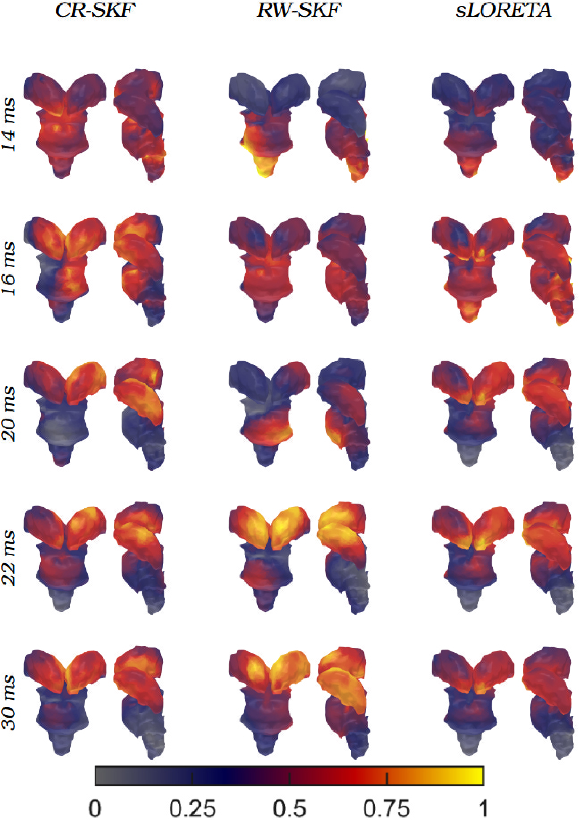 Figure 13: Visualization of spatial distribution of the Change Rate Standardized Kalman filter (CR-SKF), Random Walk-SKF (RW-SKF), and sLORETA estimations in the deep brain structures using the 2nd subject’s data. Different rows present the activity at different somatosensory evoked potential peaks.