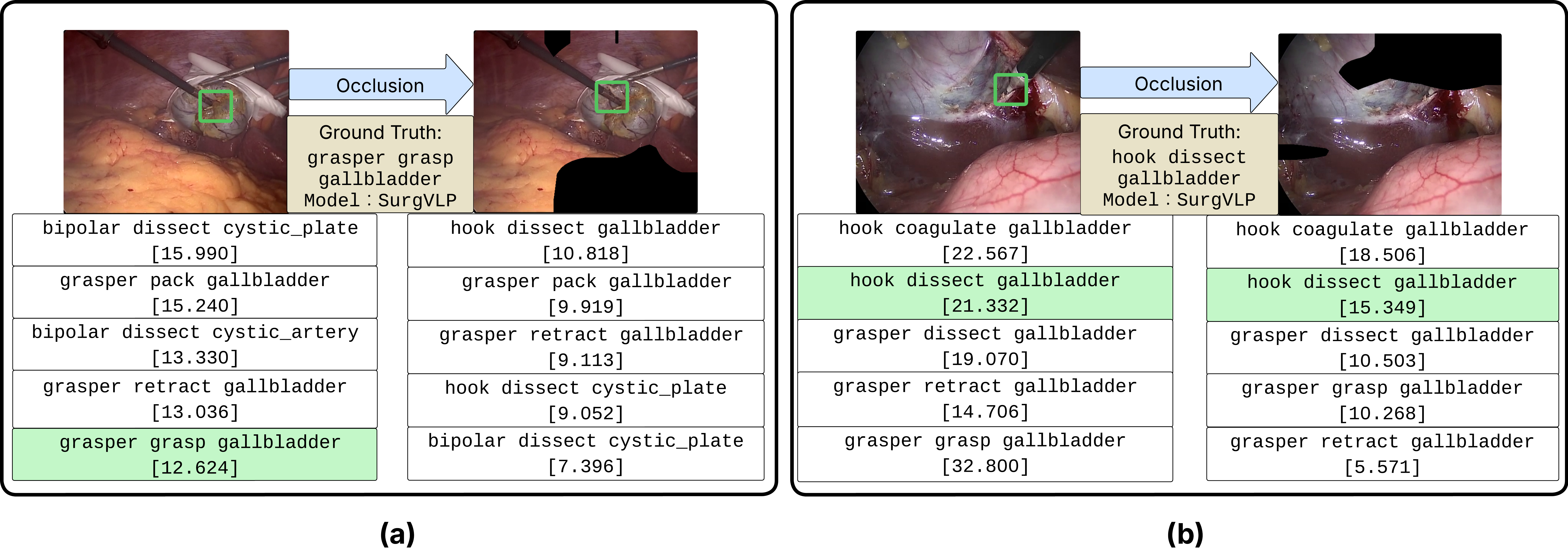 Figure 6: Counterfactual occlusion analysis results on SurgVLP. We picked two frames with the two most common instruments in the CholecT45 dataset as examples. Prompts with top-5 predicted similarity scores are shown, with the instrument tip marked by a green box in the image and corresponding prompt marked with a green background indicating IVT coverage. (a) An example of occluding irrelevant areas reducing the similarity score of the correct prediction, removing it from top-5 and leading to a wrong prediction. (b) An example of occluding relevant regions, in contrast, does not affect the prediction with correct prediction still has a relatively high similarity score.