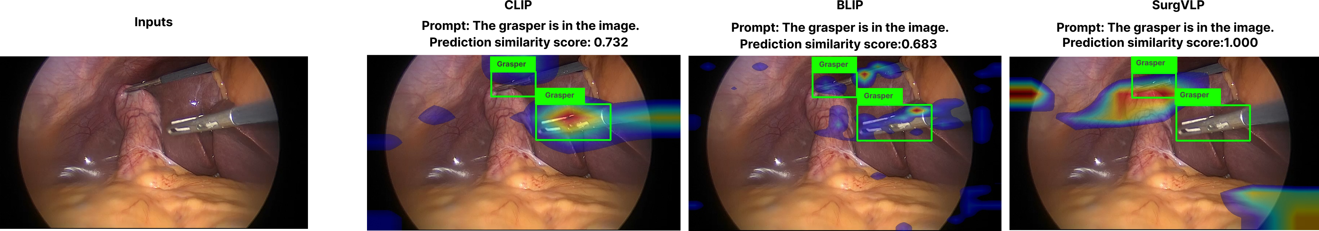 Figure 1: We evaluate two general VLMs, CLIP-ViT-B/32 [11], BLIP [18], and a surgical VLM, SurgVLP [14], on surgical instrument classification. The first image shows an input frame from the Cholec80BBox [19], [20] dataset. The next three images overlay Grad-CAM attention maps [21], [22] on top of the original images, showing each model’s focus in response to the prompt The grasper is in the image.. The similarity scores above each image indicate the model’s prediction confidence (min-max normalized). Green bounding boxes and labels are ground truth instrument locations and types.