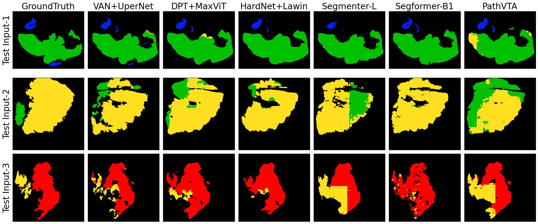 Figure 2: Qualitative experimental results for Top-6 best performing methods for 3 input test images. (Color codes for classes: Blue:Normal mucosa, Green:Grade-1, Yellow:Grade-2 , Red: Grade-3, Black:Others)