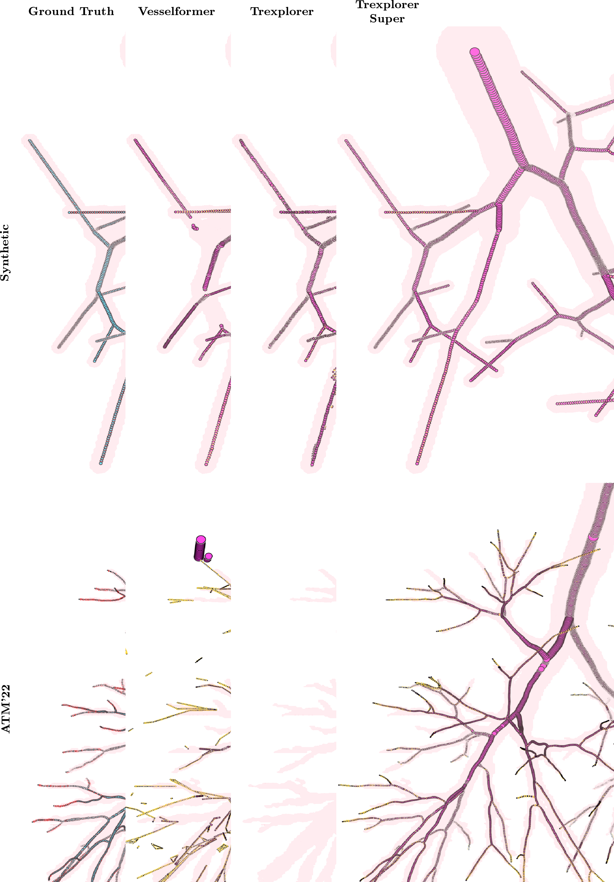 Figure 2: Visual comparison between the ground truth, Vesselformer, Trexplorer, and Trexplorer Super for one sample from each dataset. The centerline marker size is proportional to the radius value at that node.