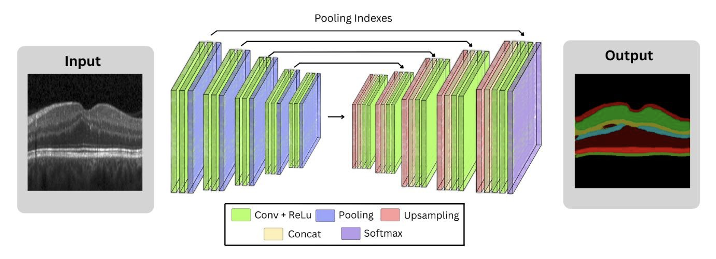 Figure 2: Overview of the SegNet architecture used for retinal layer segmentation, which processes grayscale OCT images through an encoder-decoder module.