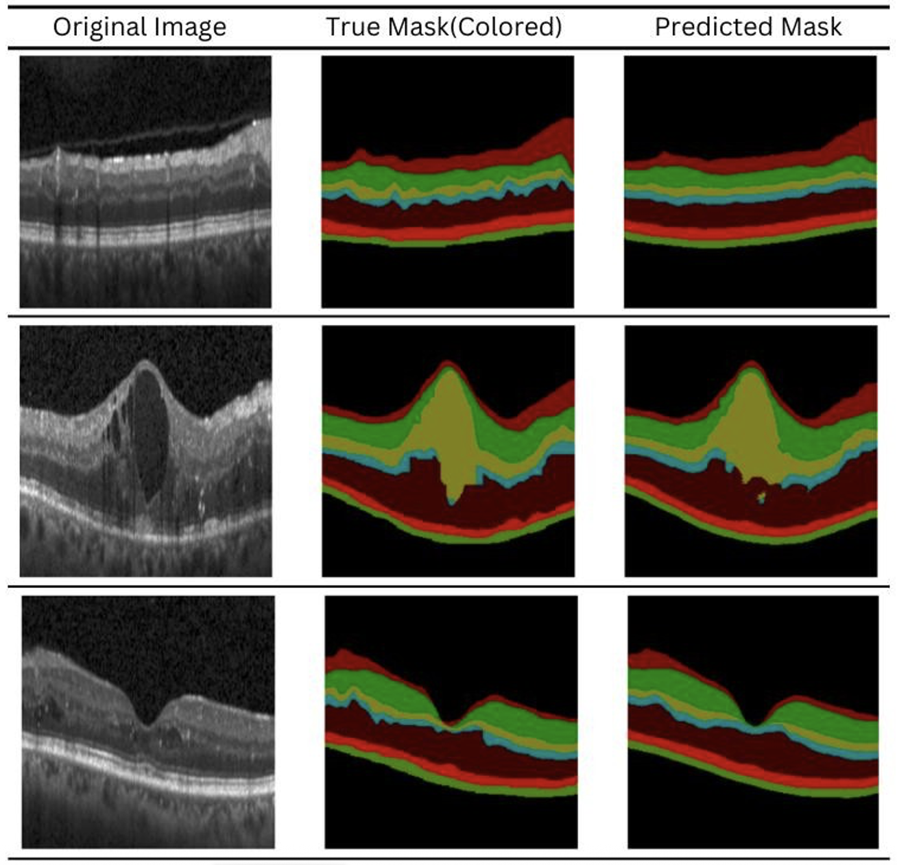 Figure 4: Visual comparison of OCT input, ground truth, and predicted retinal layer segmentation masks across three different OCT samples.