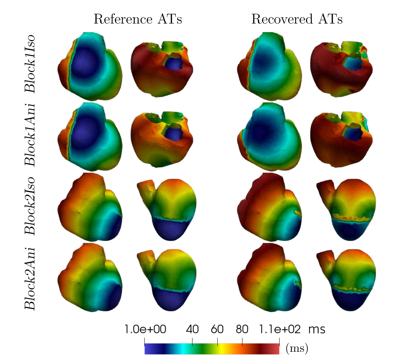 Figure 12: Activation maps obtained with an extended state which includes the choice between three geodesic distances: one homogeneous, one heterogeneous containing the true a priori conduction line of block and one heterogeneous containing a false a priori conduction line of block. The true conduction lines of block are recovered in the maps or the four test cases.