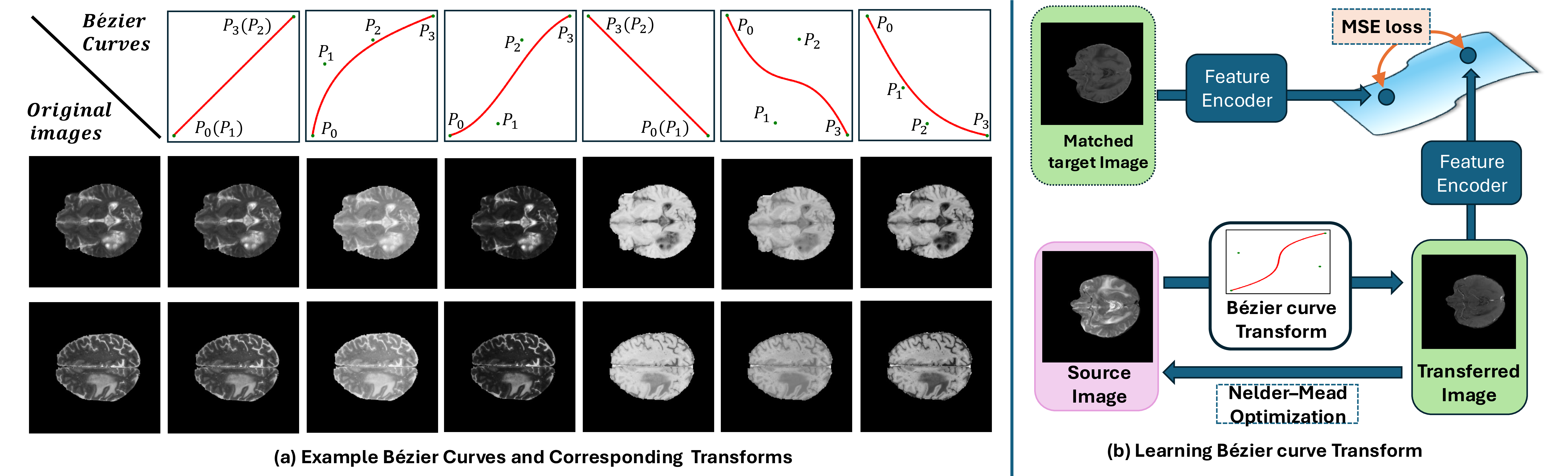 Figure 4: The overview of Bézier-curve-based style transfer. (a) illustrates the impact of varying control points on Bézier curves and their effect on medical image styles. (b) is the control points optimization process of Bézier adaptation.