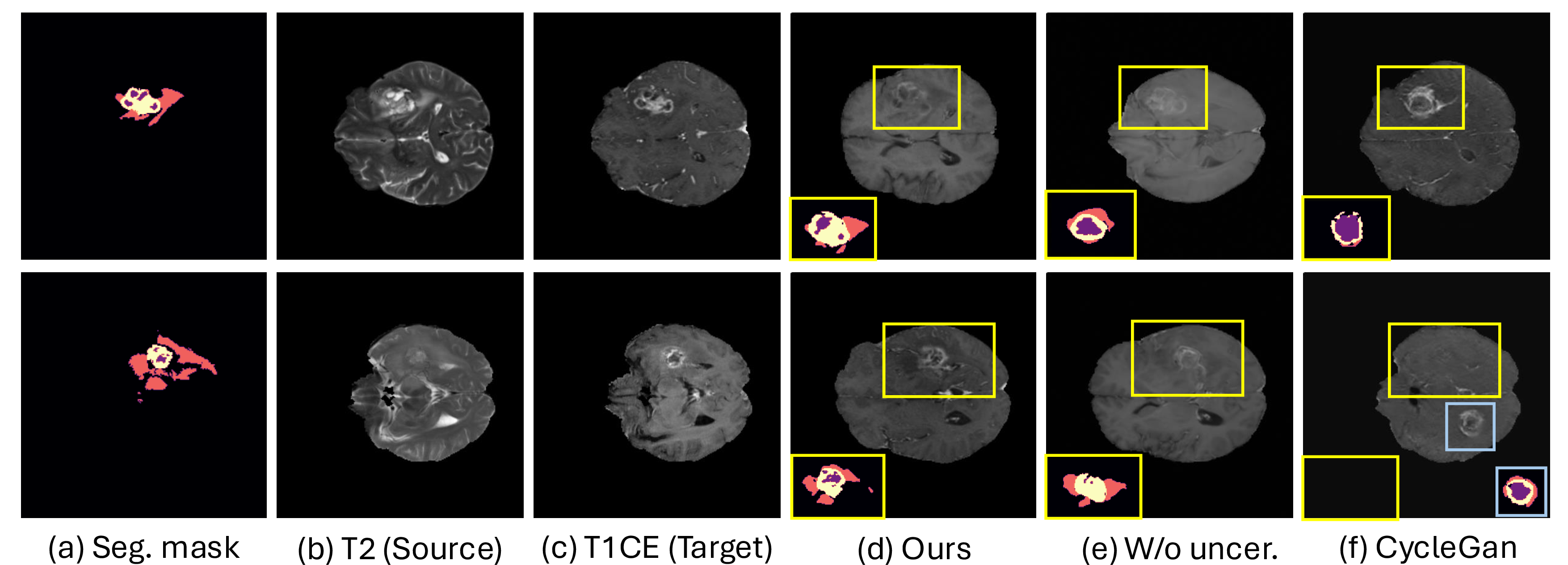 Figure 6: Qualitative results for generative models. We also show the segmentation results of the tumor region. Our method (d) is much better than baselines: CDM trained without uncertainty (e), and CycleGAN (f). In the second row, CycleGAN even hallucinates the tumor at the wrong location.