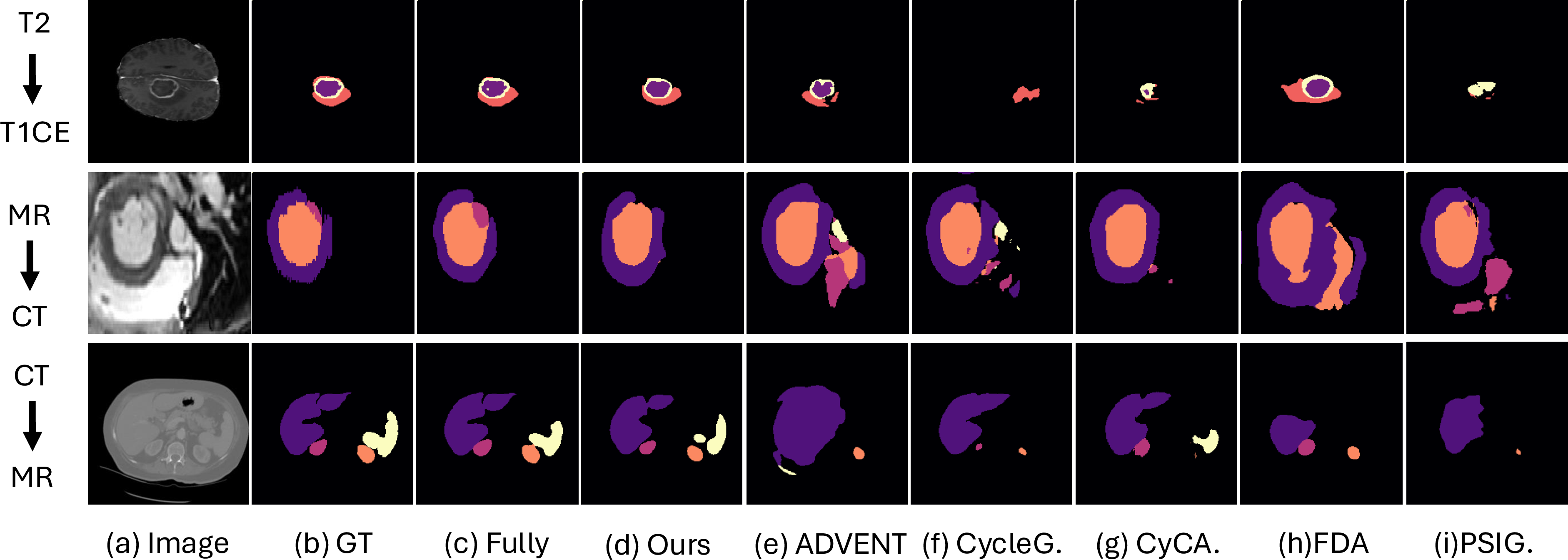 Figure 5: Segmentation results of Ours-PL and other baselines. From top to bottom: (1) BraTS dataset – Purple, orange, and yellow represent NCR, ED, and ET classes, respectively; (2) MM-WHS dataset – Purple, pink, orange, and yellow represent LVM, LAB, LVB, and AA classes, respectively; (3) Multi-Organ dataset – Purple, pink, orange, and yellow represent Liver, R. Kidney, L. Kidney, and Spleen classes, respectively.