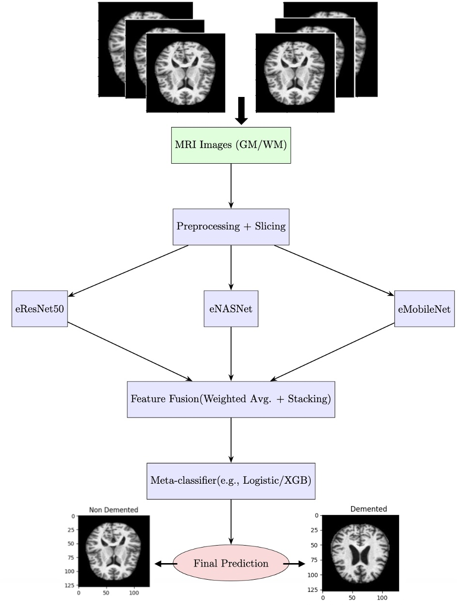 Figure 2: Workflow of the proposed Hybrid Deep Ensemble model for early diagnosis of Alzheimer’s disease. The pipeline begins with the preprocessing and slicing of MRI images (gray matter and white matter)