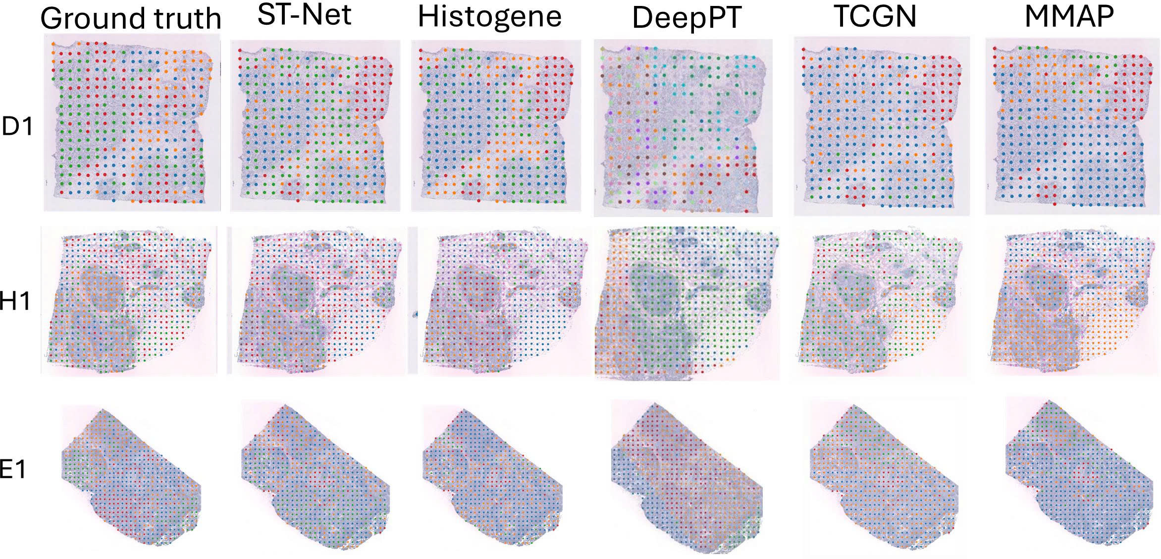 Figure 3: Visualization of gene expression on the HER2+ dataset using prediction results obtained by all methods. The ground truth represents labels from the pathologist annotations. The illustrations for each figure are obtained by performing K-means clustering.