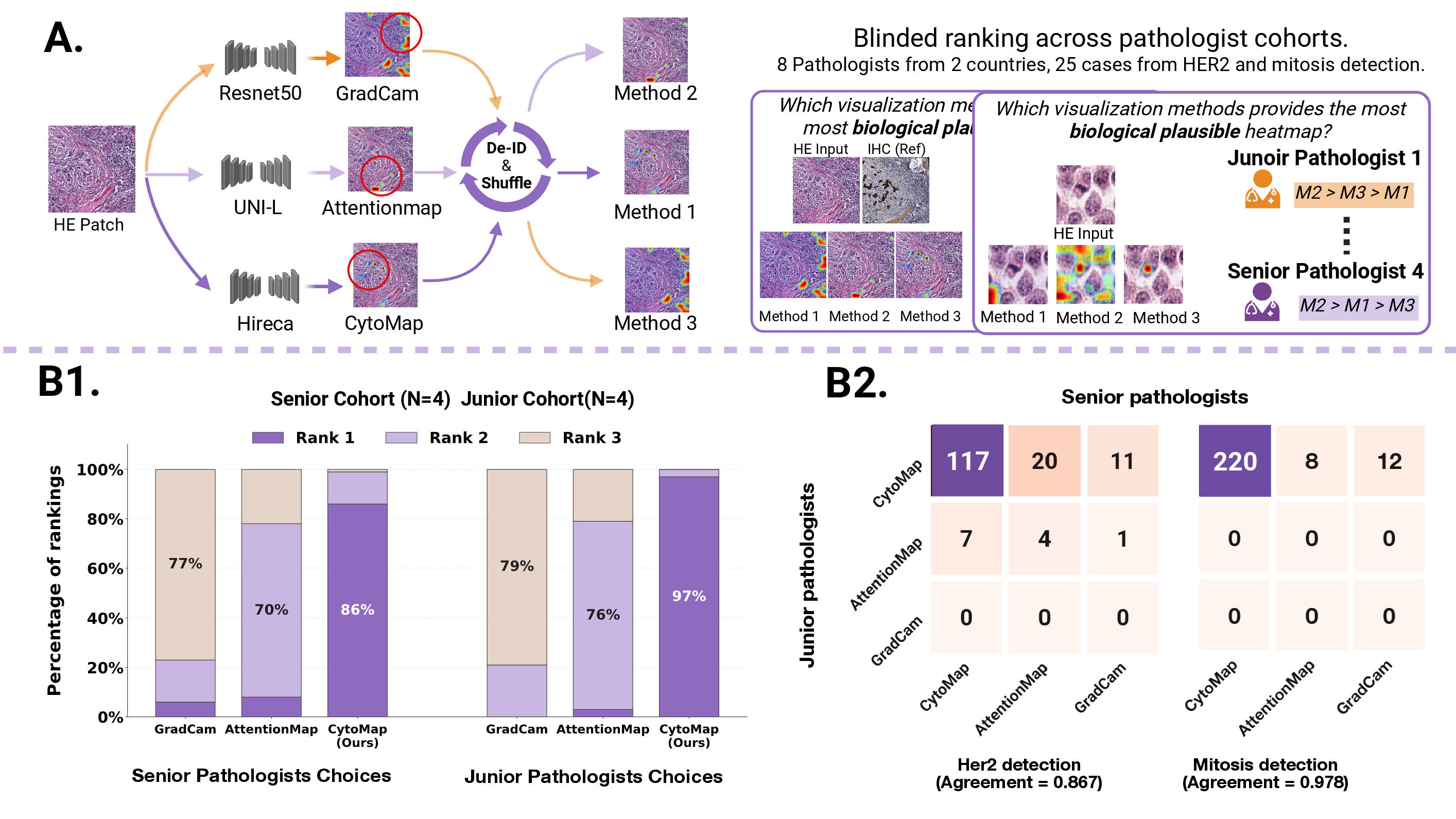 Figure 3: Pathologist preference-based interpretability evaluation of Hireca (CytoMap) against two state-of-the-art methods. A) Multi-cohort blinded pathologist ranking workflow: Visualization maps generated by GradCAM, AttentionMap, and CytoMap were de-identified and randomly shuffled as Method 1–3. Eight pathologists from Germany and China, including four senior and four junior pathologists, independently ranked the three methods across 25 cases from HER2 and mitosis detection according to biological relevance. B1) Preference ranking results from junior and senior pathologist cohorts: Stacked bar charts show the percentage distribution of Rank 1, Rank 2, and Rank 3 assignments in each cohort. CytoMap received the highest proportion of Rank 1 selections in both cohorts (86% senior and 97% junior), indicating consistent preference over the two state-of-the-art interpretability methods. B2) Agreement analysis between senior and junior pathologist cohorts: Confusion matrices compare cohort-level rankings for HER2 and mitosis detection, showing strong diagonal concentrations and confirming that the preference pattern observed in B1 is reproducible across experience levels. The agreement scores were 0.867 for HER2 and 0.978 for mitosis detection.