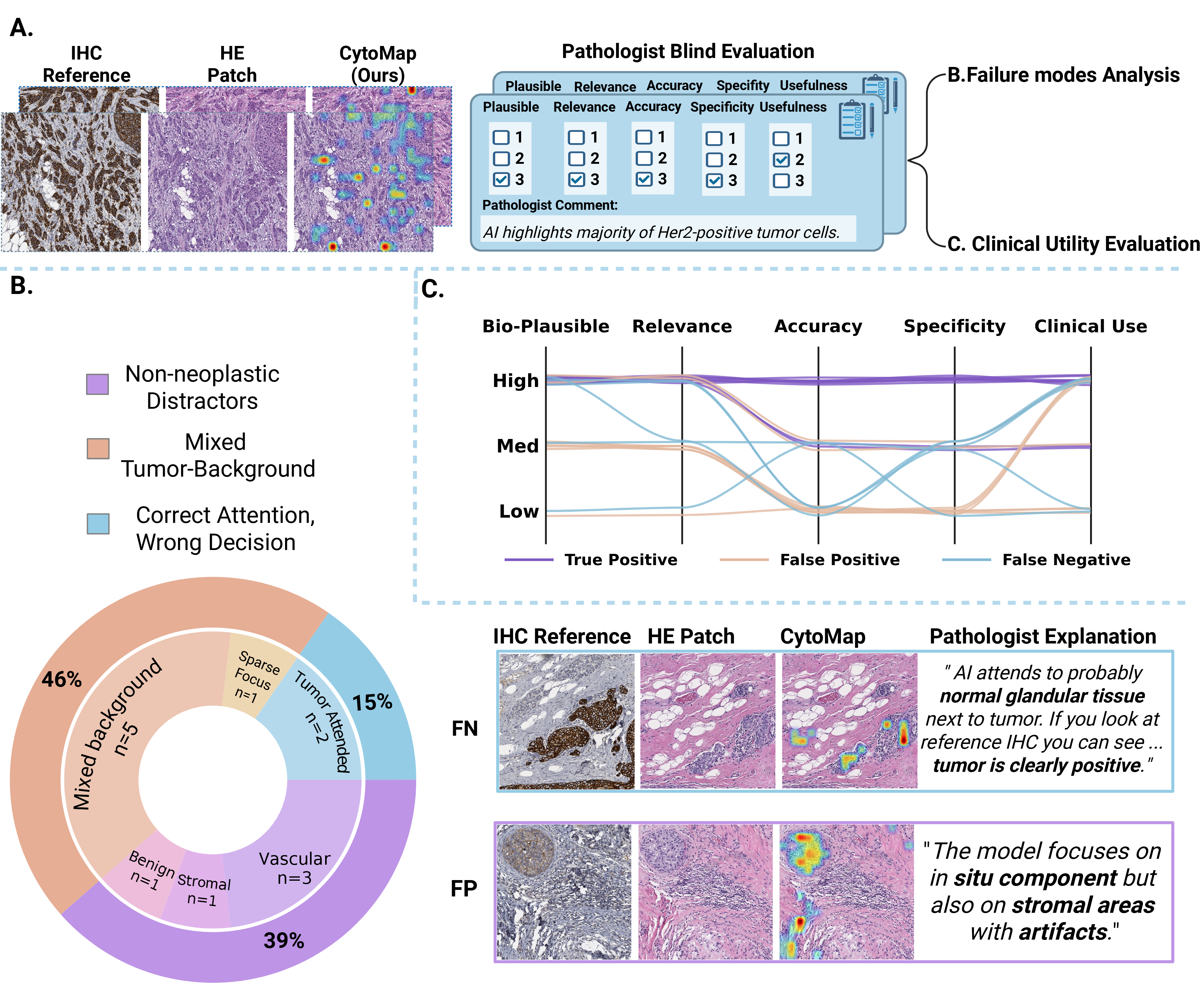Figure 4: Pathologist score-based interpretability evaluation of Hireca (CytoMap) for HER2 assessment. A) Pathologist-in-the-loop assessment workflow: For HER2 true-positive (TP), false-positive (FP), and false-negative (FN) cases, pathologists reviewed the IHC reference, the corresponding HE patch, and the CytoMap visualization. They scored the clinical utility of the highlighted evidence across multiple dimensions and provided comments explaining the reasons for successful or failed predictions. These scores and comments were further used for clinical utility evaluation and failure-case analysis. B) Failure-case analysis: FP and FN cases were reviewed by pathologists and categorized according to their dominant failure reason, including non-neoplastic distractors, mixed tumor-background attention, and correct attention with incorrect model decision. Colours denote different failure categories, and two representative examples are shown on the right. C) Multidimensional clinical utility evaluation: All cases were scored by pathologists using the prediction results and IHC reference across five dimensions: biological plausibility, relevance, accuracy, specificity, and clinical usefulness. Notably, clinical usefulness remained relatively high across case types, suggesting that cellular-scale CytoMap visualizations may support both correct case interpretation and error understanding.