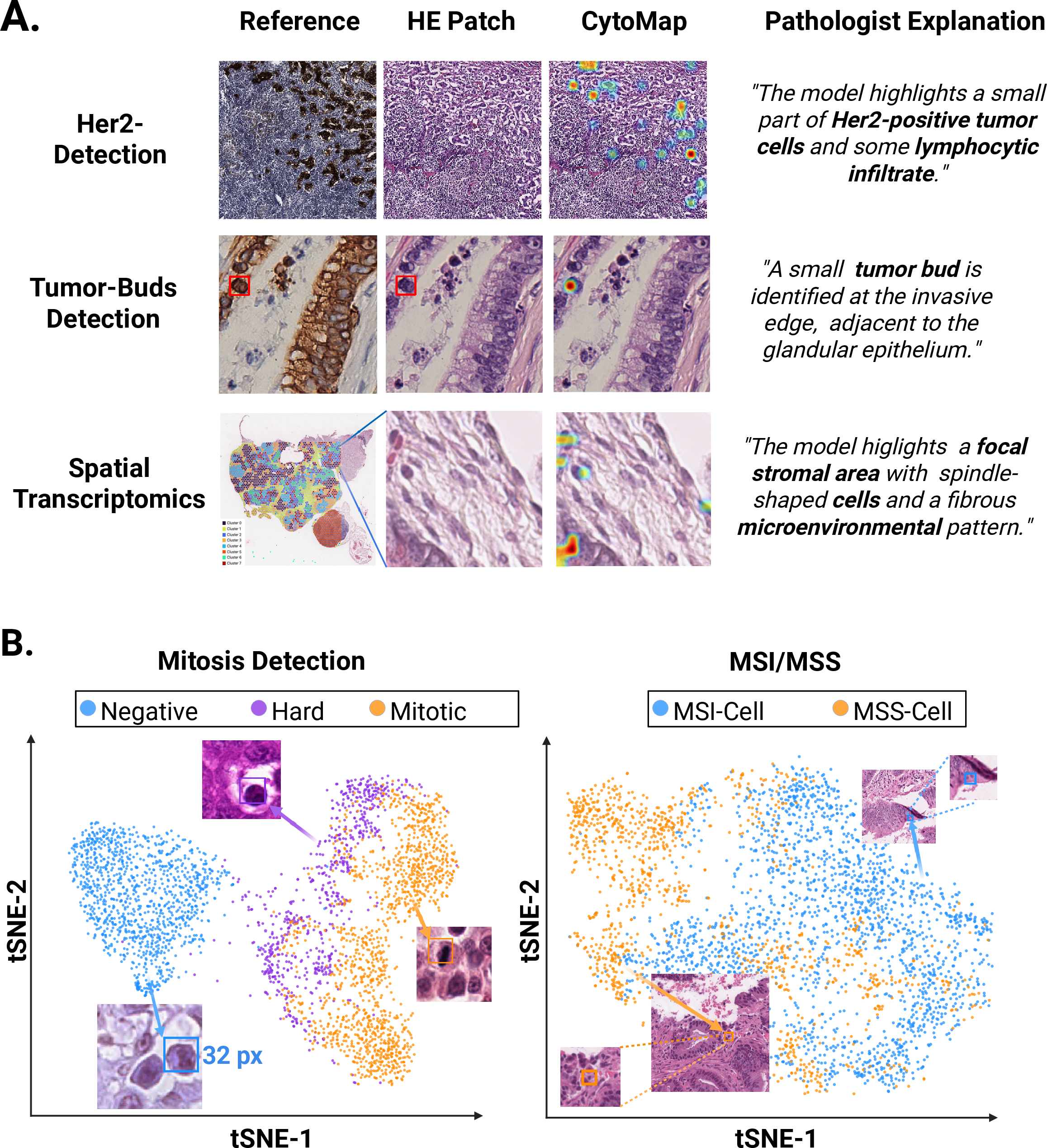 Figure 5: CytoMap provides pathologist-observable and representation-space cellular-scale evidence. A) Pathologist-observable evidence for cellular-scale interpretability: Representative examples across HER2 detection, tumor-bud detection, and spatial transcriptomic proxy prediction show that CytoMap highlights fine-grained cellular or microenvironmental structures that can be directly interpreted by pathologists. B) Representation-space evidence for cellular-scale interpretability: T-SNE visualization of CytoMap-highlighted patch-token features shows task-relevant organization for mitosis detection and MSI/MSS prediction, suggesting that the highlighted regions correspond to meaningful cellular morphology rather than arbitrary visual attention.