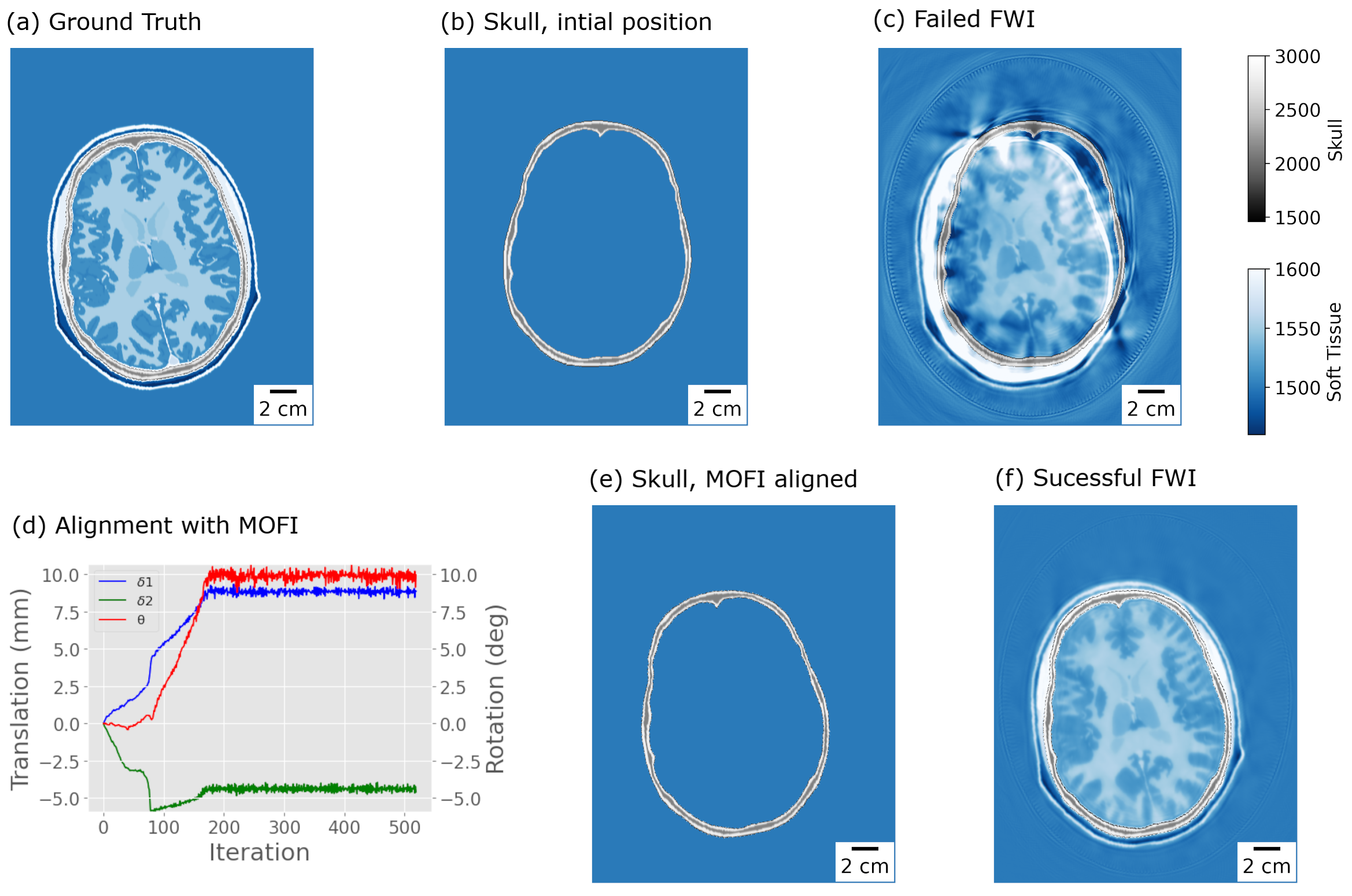 Figure 2: In-silico wavefield data are simulated from (a) the ground truth sound speed. (b) The skull template at the initial position produces (c) a failed FWI reconstruction. (d) MOFI identifies the correct translation (\mathrm{\delta1, \delta2}) and rotation (\mathrm{\theta}). (d) The MOFI aligned skull template produces (f) a successful FWI reconstruction.