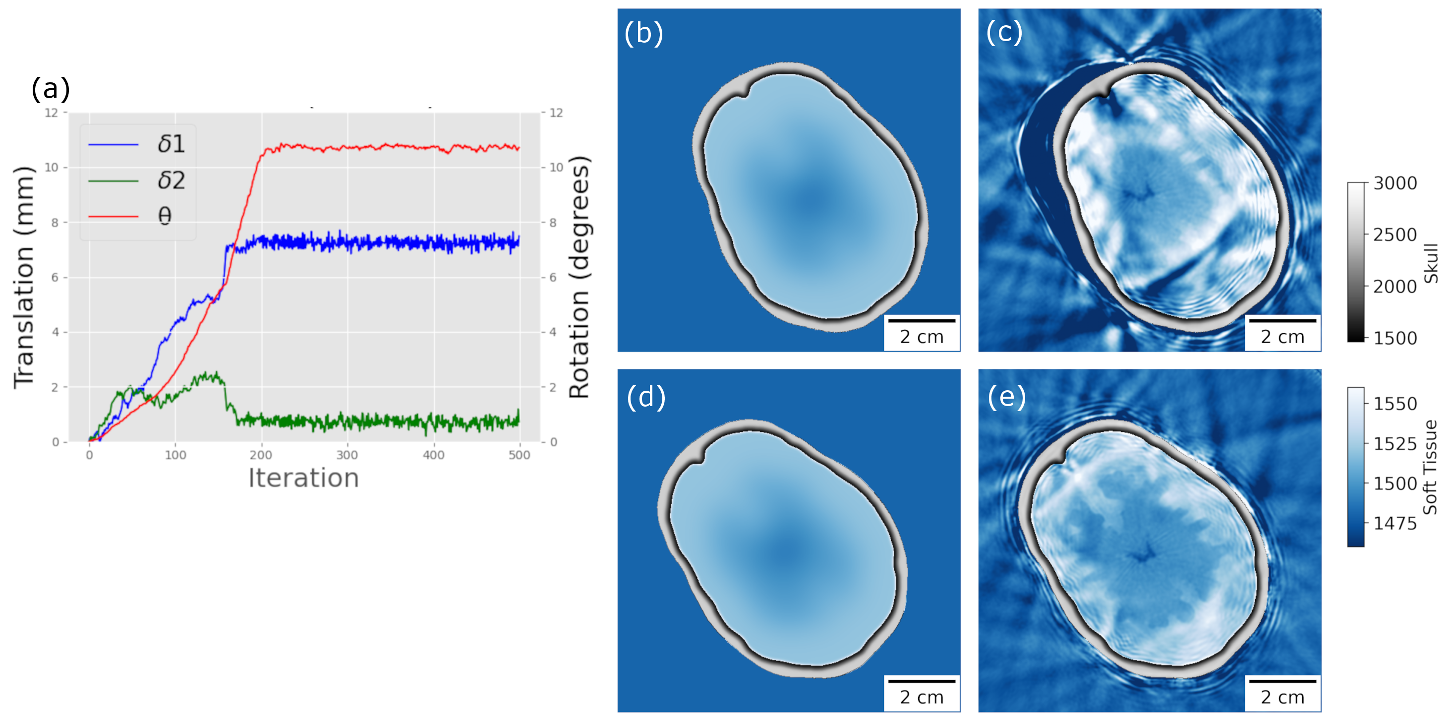Figure 4: (a) MOFI identifies a translation \boldsymbol{\delta}=(7.2 \pm 0.2, 0.7 \pm 0.2) \, \mathrm{mm} and a rotation \mathrm{\theta} = 10.71 \pm 0.07^\mathrm{o}. (b) The skull template at the initial position produces (c) a failed FWI reconstruction. (d) The MOFI aligned skull template provides (e) a successful FWI reconstruction.