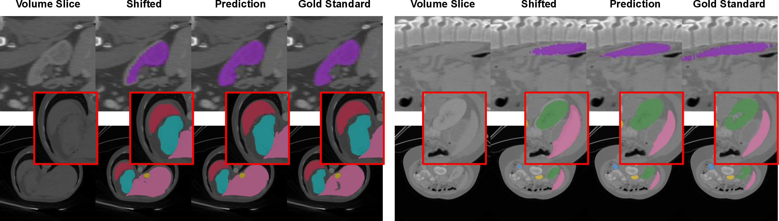 Figure 6: Qualitative visuals depicting spatially shifted prompts (zoomed-in) and their respective predictions for abdominal organs, using SAM-Med3D (top) and nnInteractive (bottom).
