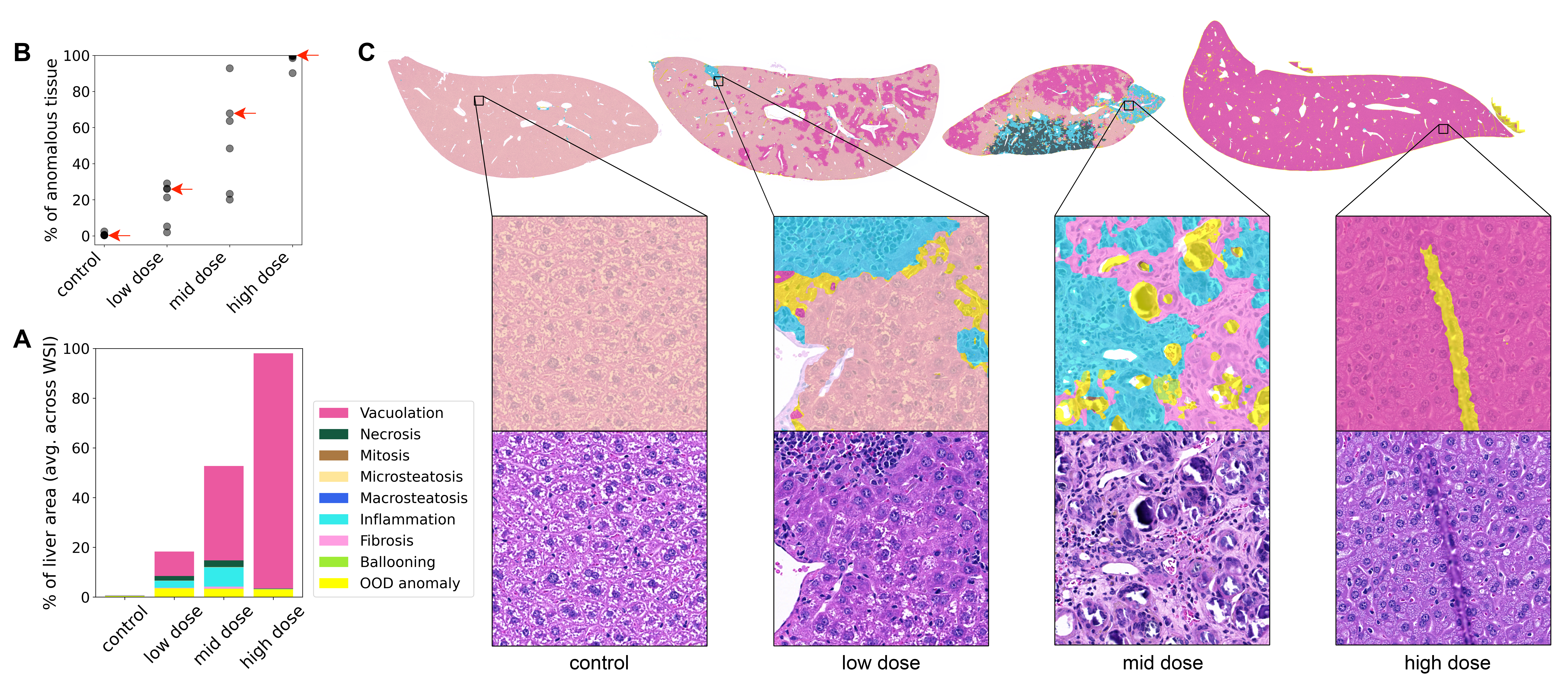 Figure 10: Detection of adverse drug reactions in a preclinical toxicological liver study. Our approach (Adaptive-Maha+) disentangles dose-dependent toxicologic effects from vehicle-related and incidental anomalies at pixel level. A. Percentage of liver area occupied by different anomalies (averaged across WSIs) is shown for each dose group. Results correspond to pathological alterations and were confirmed by a pathologist. B. Each dot corresponds to a single WSI and shows total percentage of anomalies in the WSI. Four arrows correspond to four WSI examples given in C. C. Examples of detected anomalies in different groups. Cytoplasmic vacuolation shows dose dependency, while other anomaly types do not.