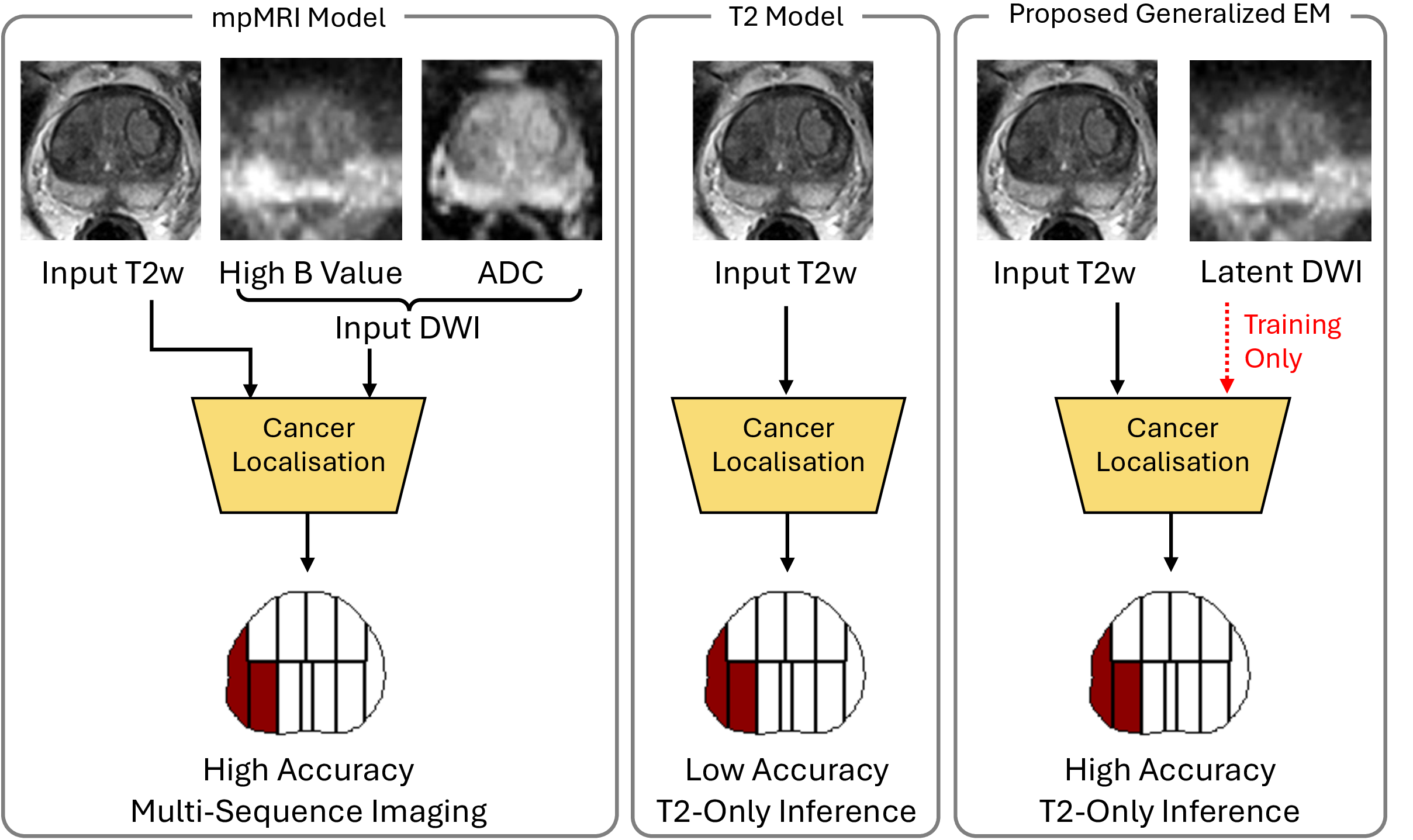 Figure 1: Prostate cancer localization paradigms. Unlike standard mpMRI requiring multi-sequence inputs, our proposed Generalized EM leverages DWI strictly as a latent modality during training. This enables high-accuracy inference using only T2w images, overcoming the limitations of standard T2 models. Red denotes ISUP\ge​3.