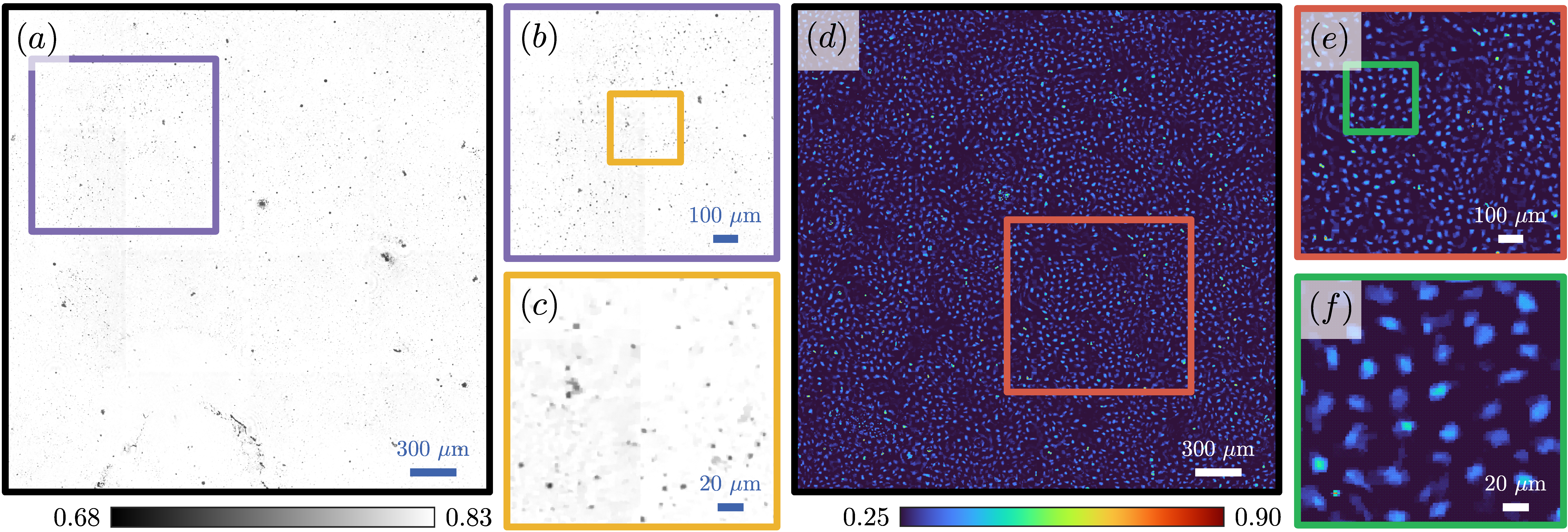 Figure 4: Single-shot reconstructions of amplitude and phase dominant samples using evolved policy. (a) Reconstructed amplitude of a microparticle sample at 520~\mathrm{nm}. (b) Inset from (a) shows representative regions with well-defined particle boundaries. (c) Inset from (b). (d) Reconstructed phase of a cellular sample at 638~\mathrm{nm}, shown after linear normalisation for visualisation. (e) Inset from (d) highlights cell boundaries and the separation of neighbouring cells. (f) Inset from (e).