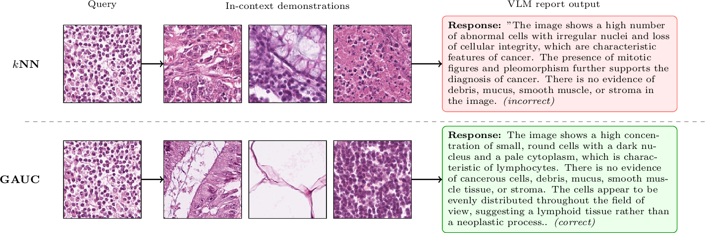 Figure 2: Qualitative comparison. Top: kNN selects morphologically redundant demonstrations, leading to a misclassification. Bottom: GAUC provides diverse, globally representative demonstrations yielding the correct diagnosis.