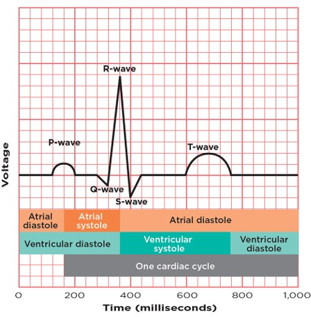 Figure 1: A single ECG complex. Schematic taken from [1]