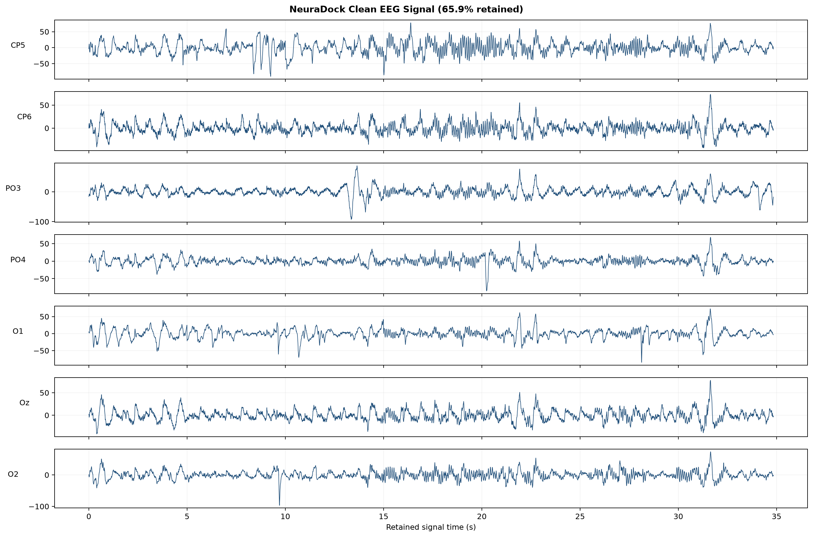 Figure 2: Clean EEG signal after preprocessing and QC gating for open_closed_eye2.txt. Later tutorial metrics are based on this quality-gated workflow rather than raw EEG alone.