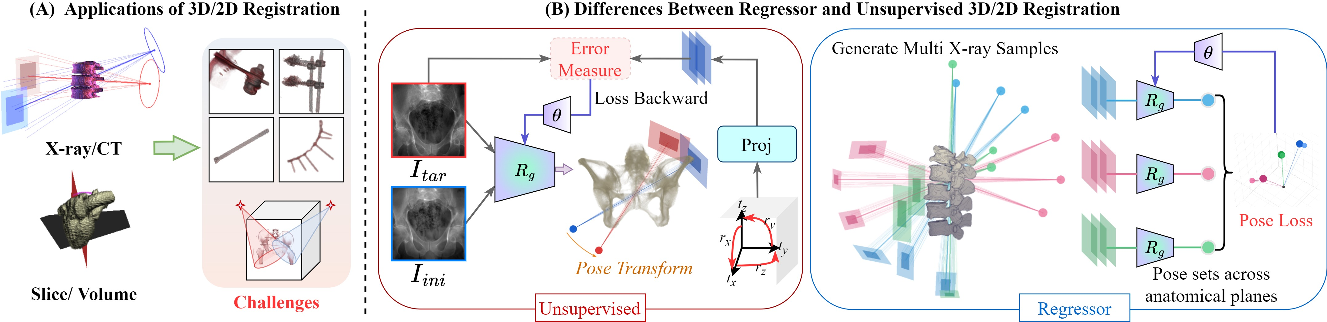 Figure 1: (A) Application scenarios of 3D/2D registration and existing challenges (e.g., occlusion, large misalignment). (B) Comparison of two training pipelines, unsupervised registration (red) and regressor-based (blue). R_g is the registration model.