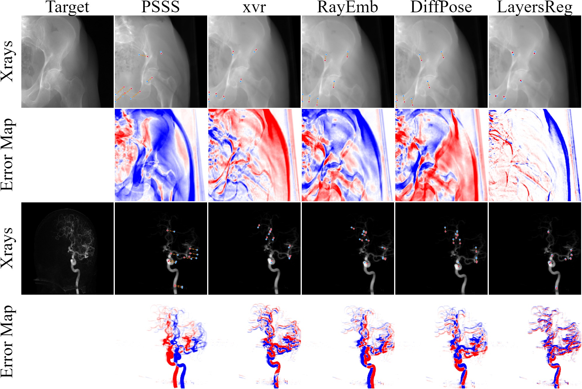 Figure 7: Compared with SOTA methods on surgery X-rays. Orange lines indicate landmark offset; the 2nd and 4th rows show error maps (vs. GT).